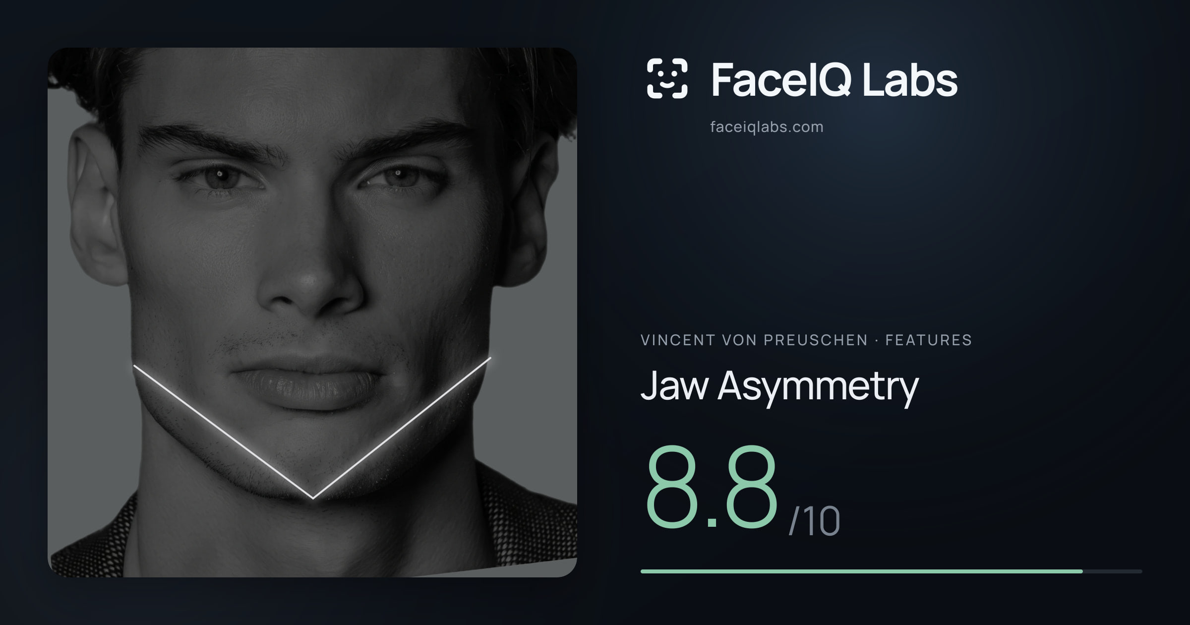 Vincent von Preuschen Jaw Asymmetry: 8.8/10, drawn on the photo