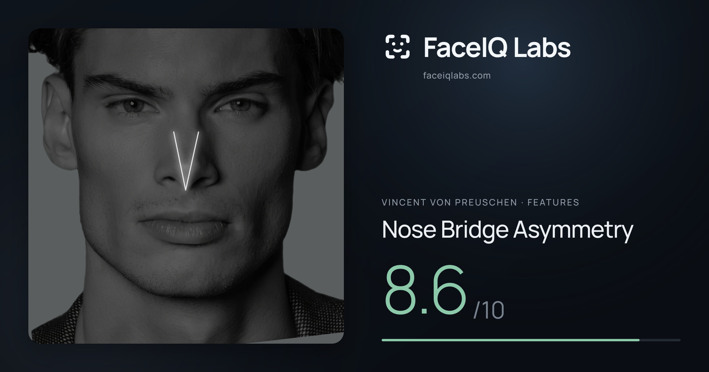 Vincent von Preuschen Nose Bridge Asymmetry: 8.6/10, drawn on the photo