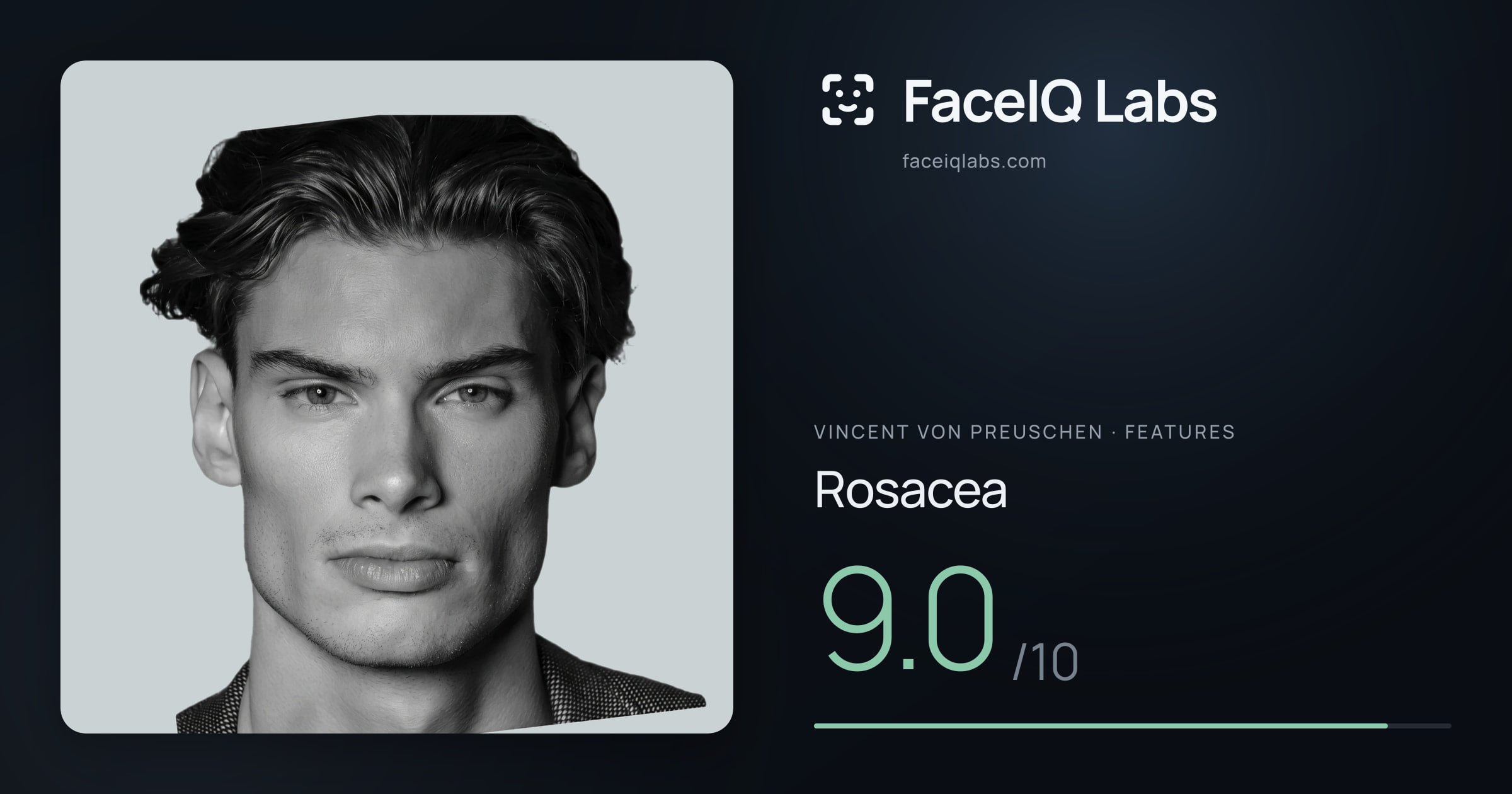 Vincent von Preuschen Rosacea: 9.0/10, drawn on the photo