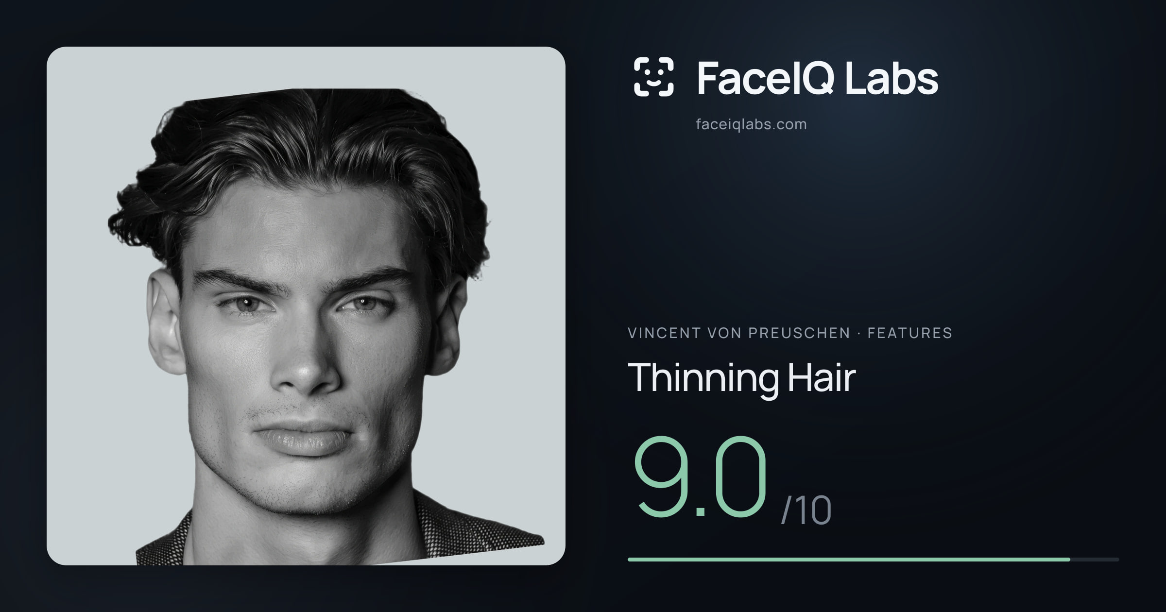 Vincent von Preuschen Thinning Hair: 9.0/10, drawn on the photo