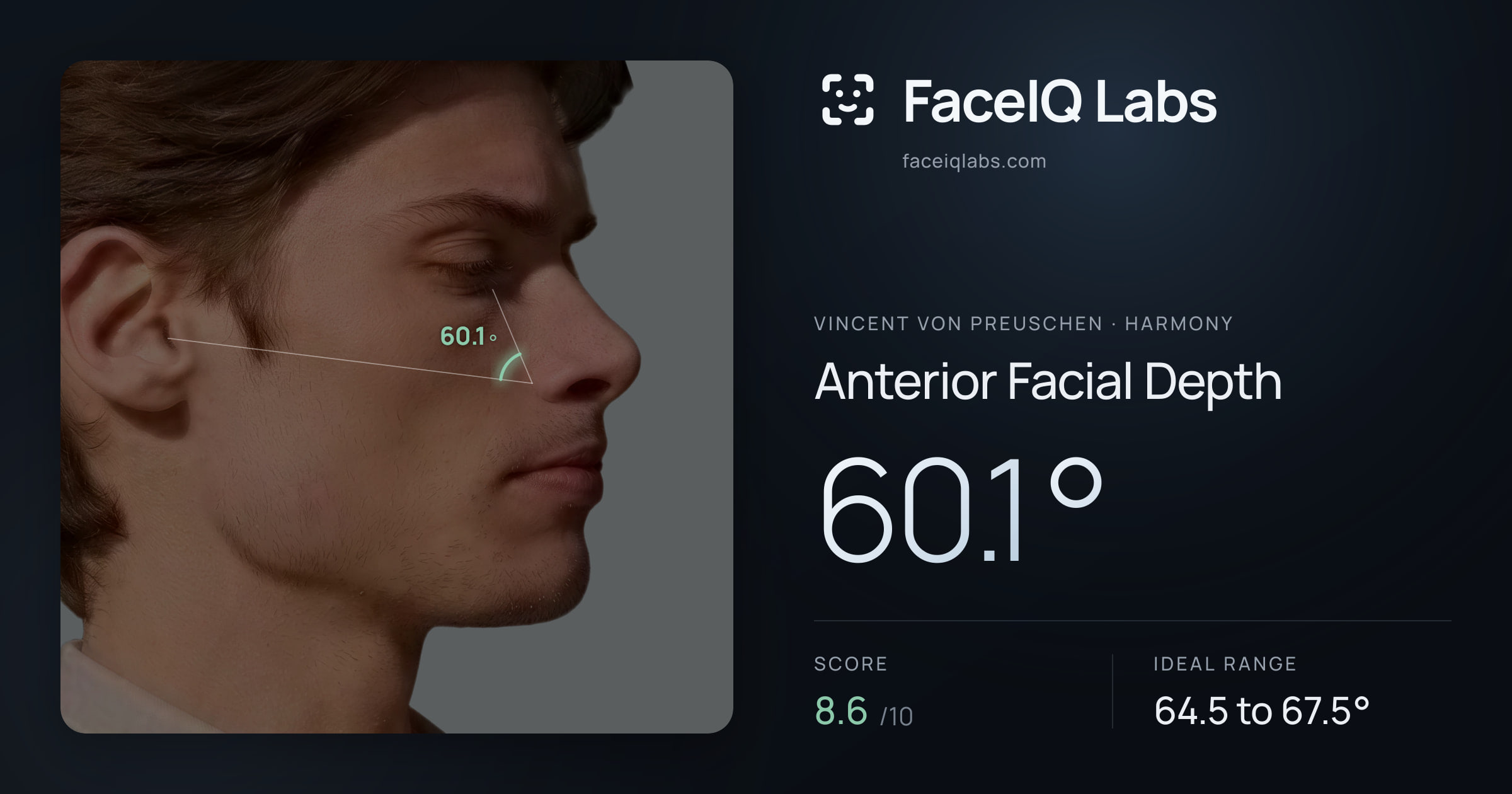 Vincent von Preuschen Anterior Facial Depth: 60.1°, drawn on the photo
