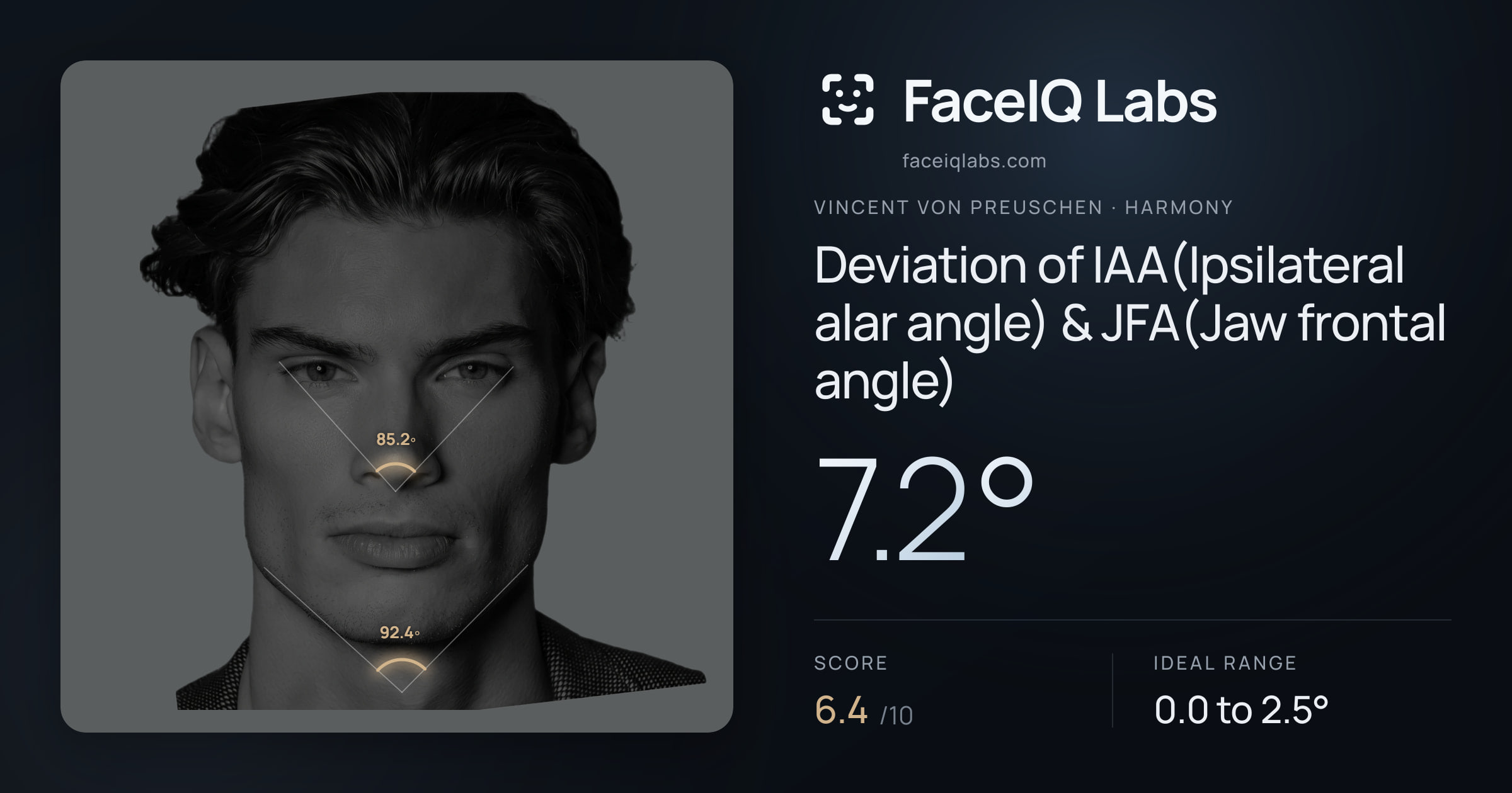 Vincent von Preuschen Deviation of IAA(Ipsilateral alar angle) & JFA(Jaw frontal angle): 7.2°, drawn on the photo