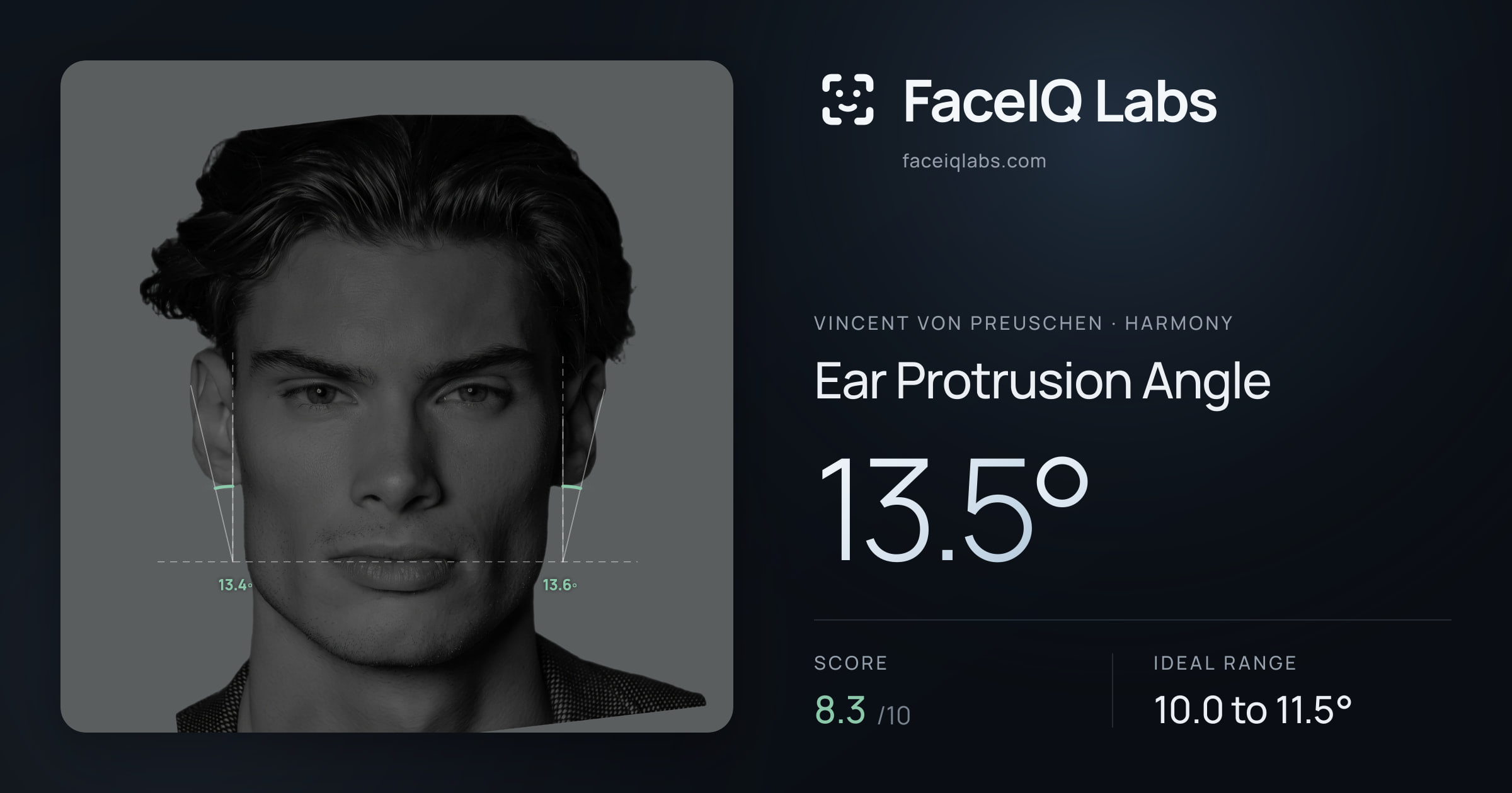 Vincent von Preuschen Ear Protrusion Angle: 13.5°, drawn on the photo