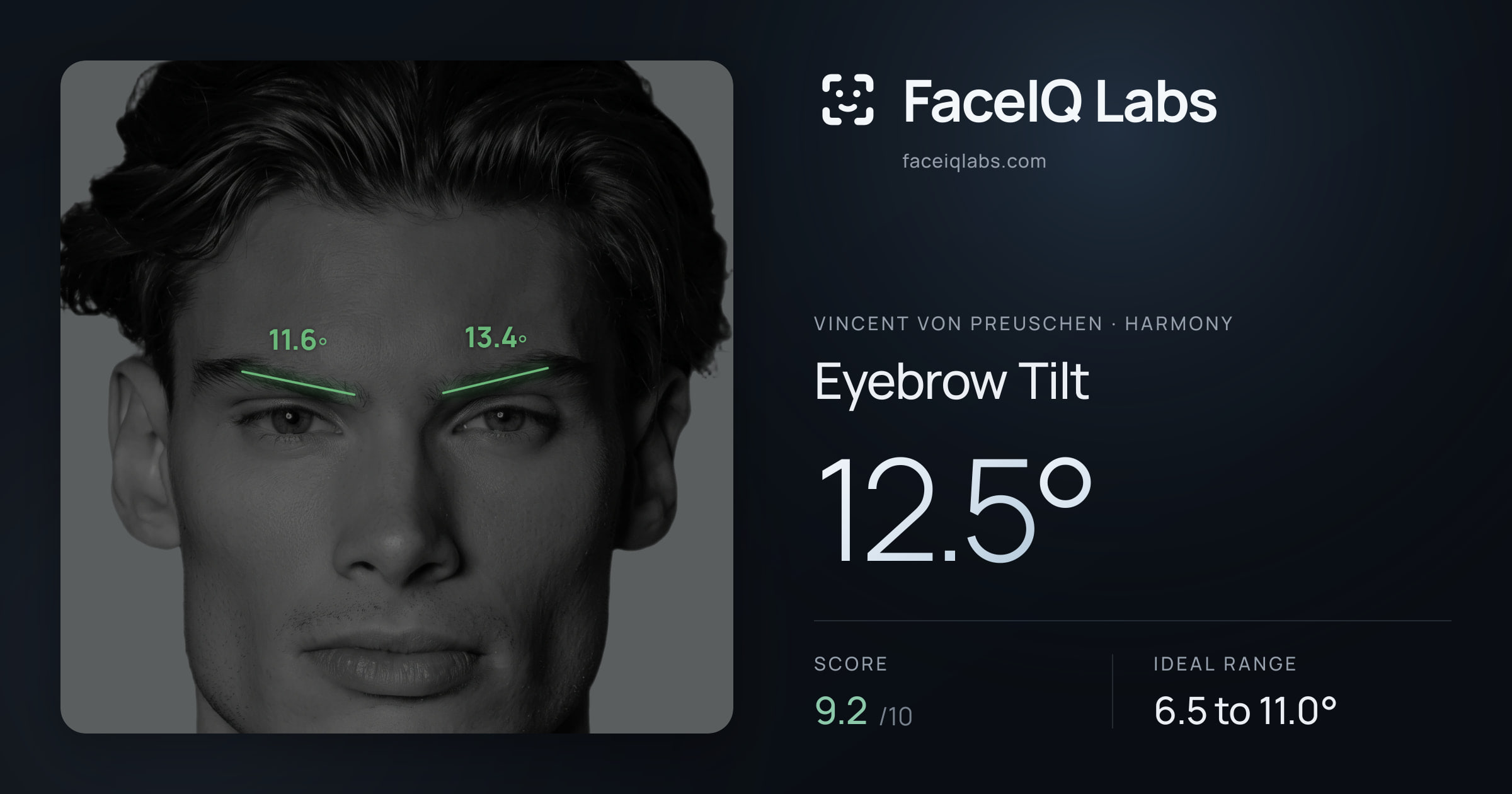 Vincent von Preuschen Eyebrow Tilt: 12.5°, drawn on the photo
