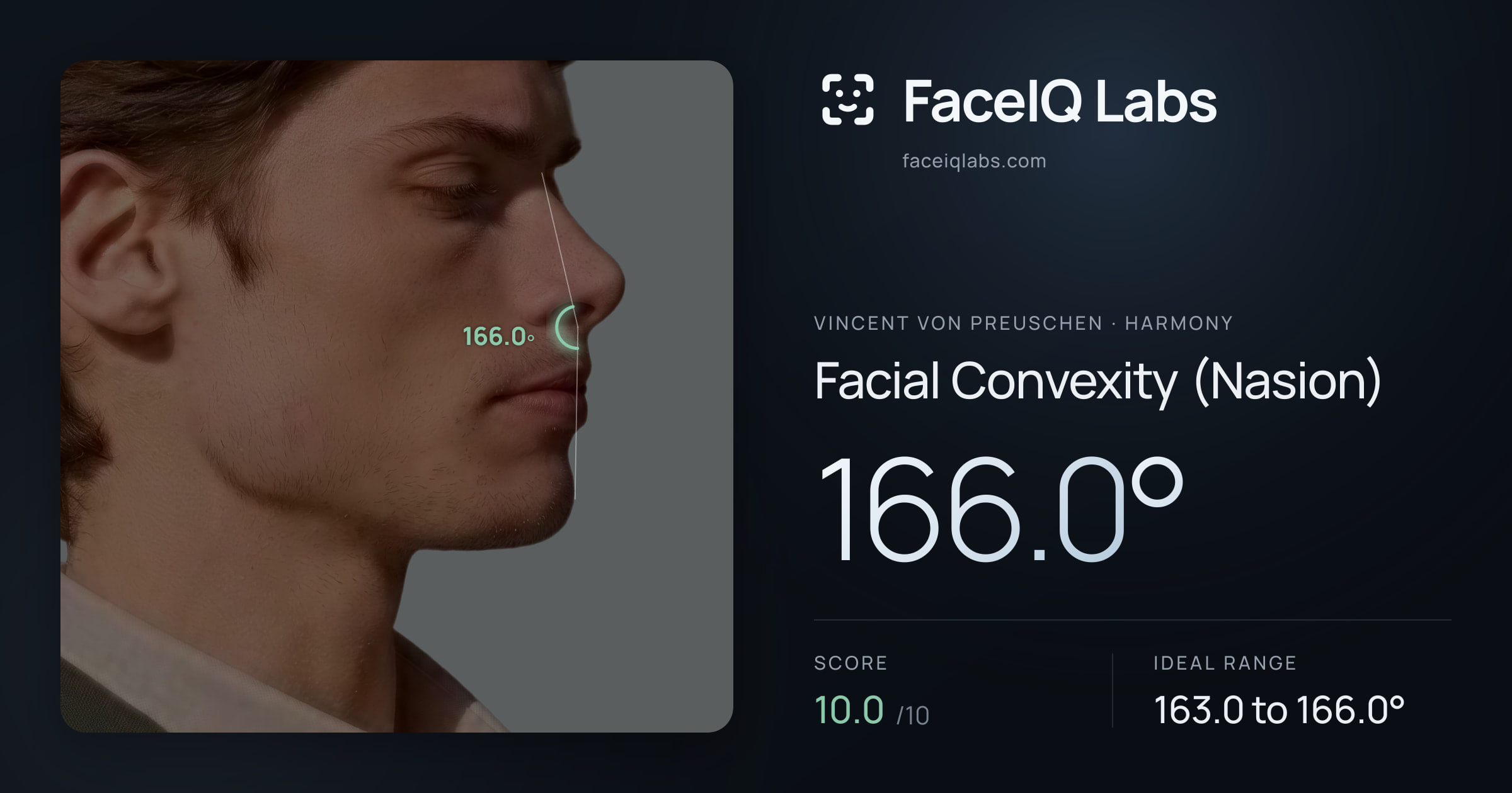 Vincent von Preuschen Facial Convexity (Nasion): 166.0°, drawn on the photo