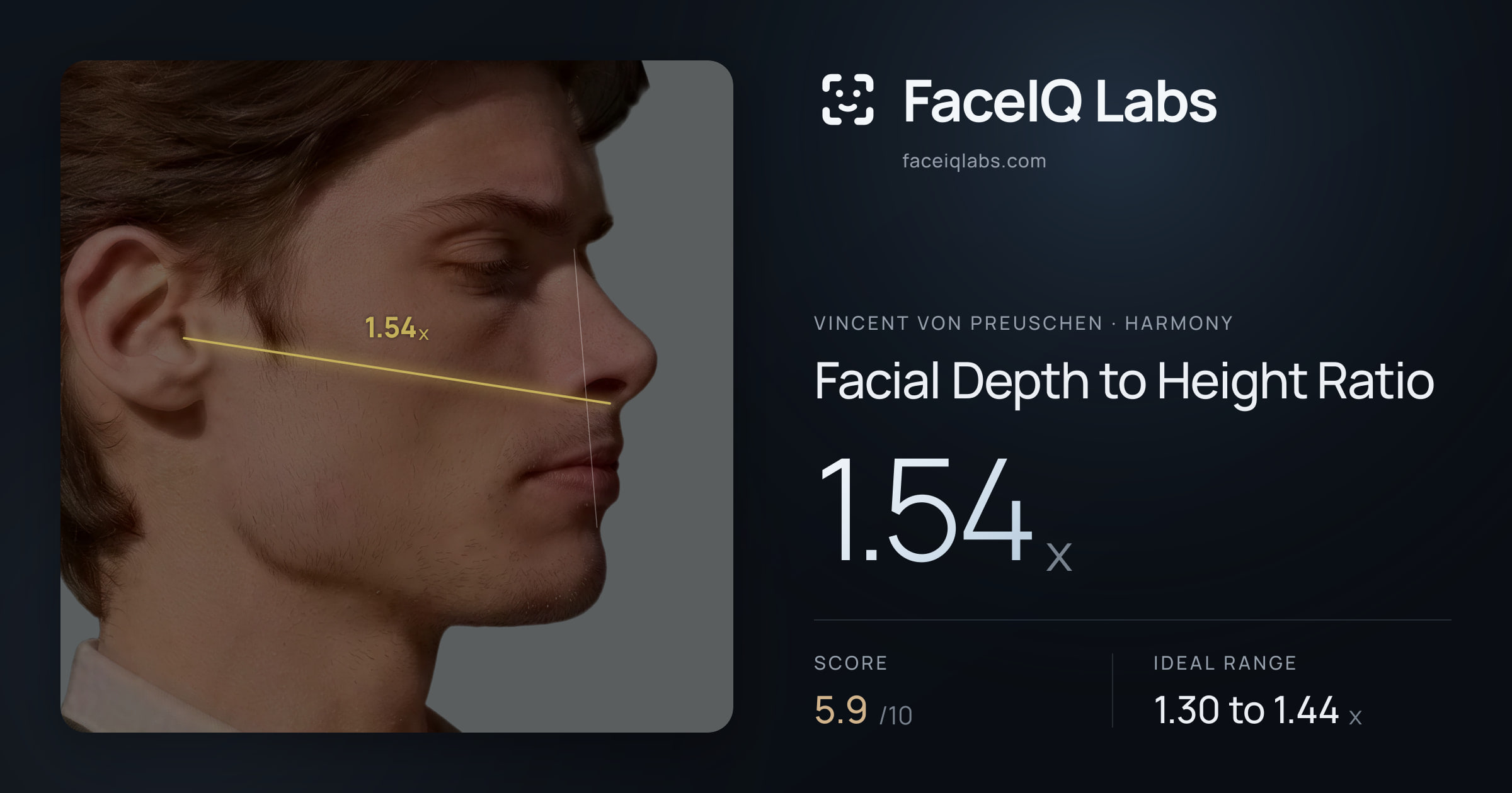 Vincent von Preuschen Facial Depth to Height Ratio: 1.54x, drawn on the photo