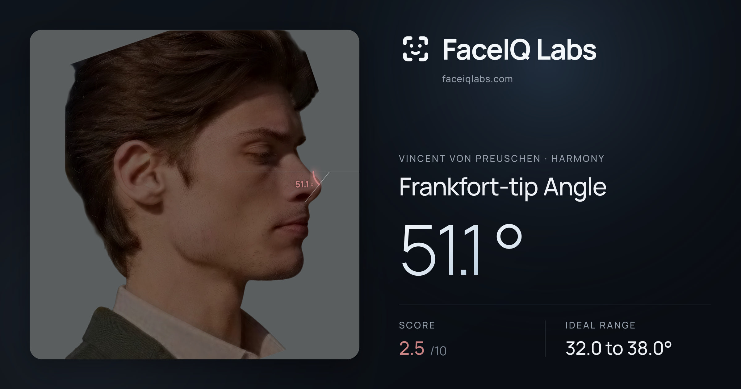 Vincent von Preuschen Frankfort-tip Angle: 51.1°, drawn on the photo