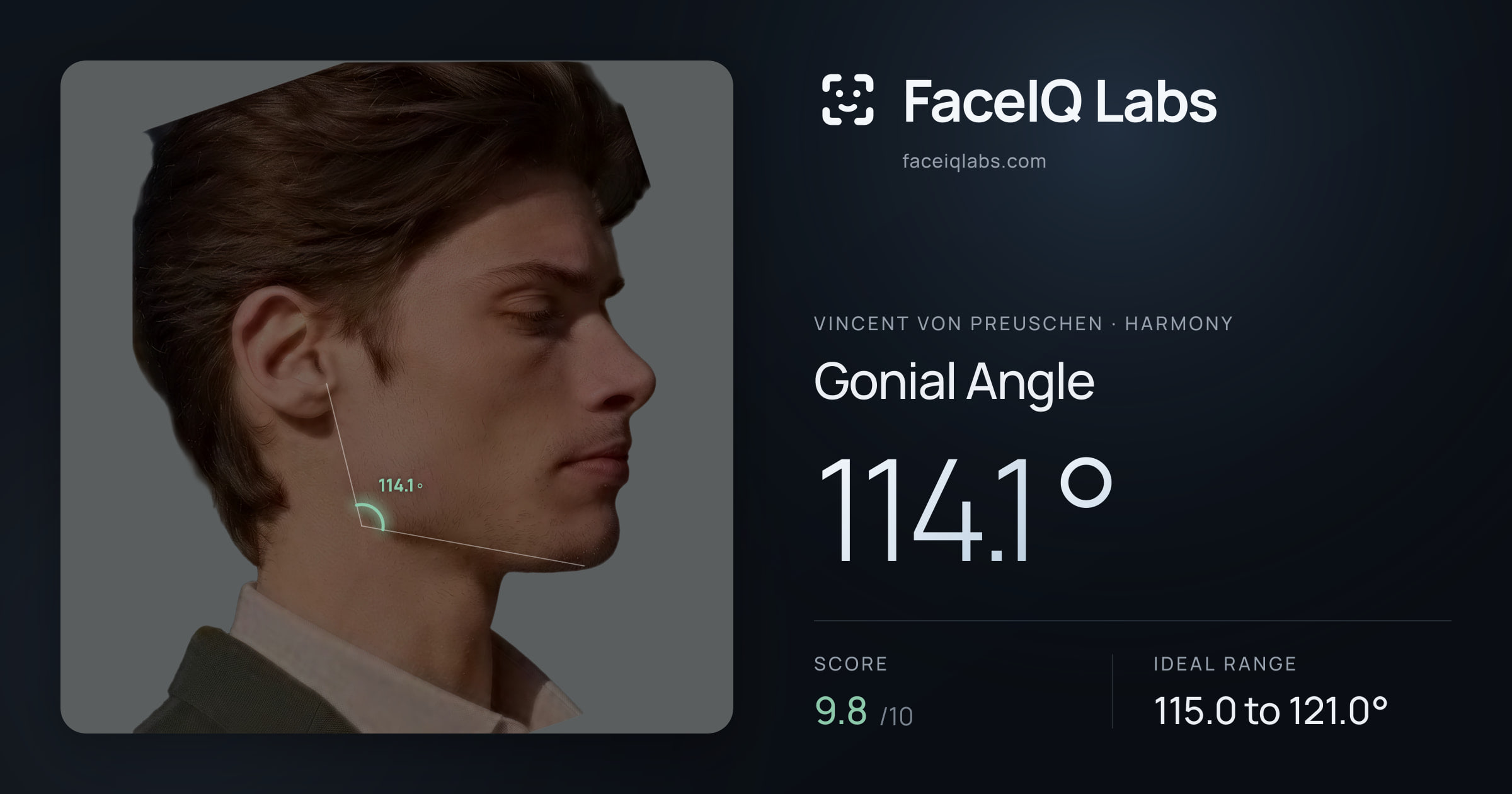 Vincent von Preuschen Gonial Angle: 114.1°, drawn on the photo