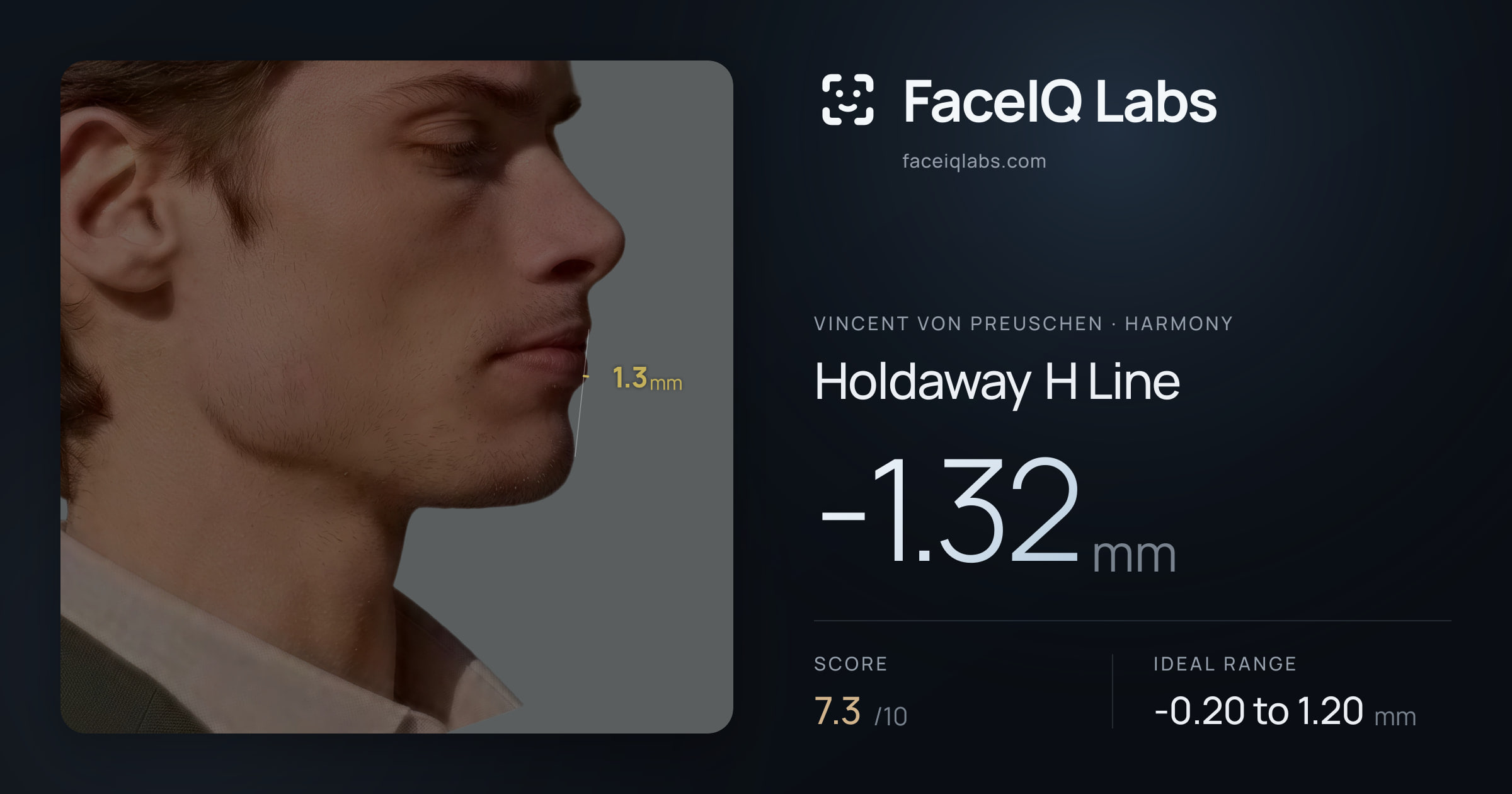 Vincent von Preuschen Holdaway H Line: -1.32mm, drawn on the photo