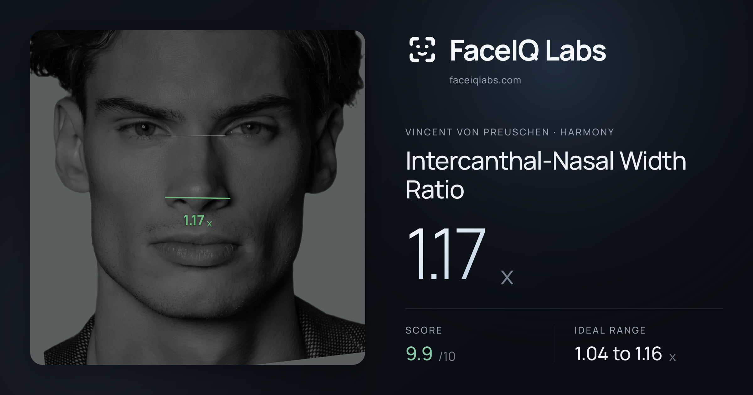 Vincent von Preuschen Intercanthal-Nasal Width Ratio: 1.17x, drawn on the photo