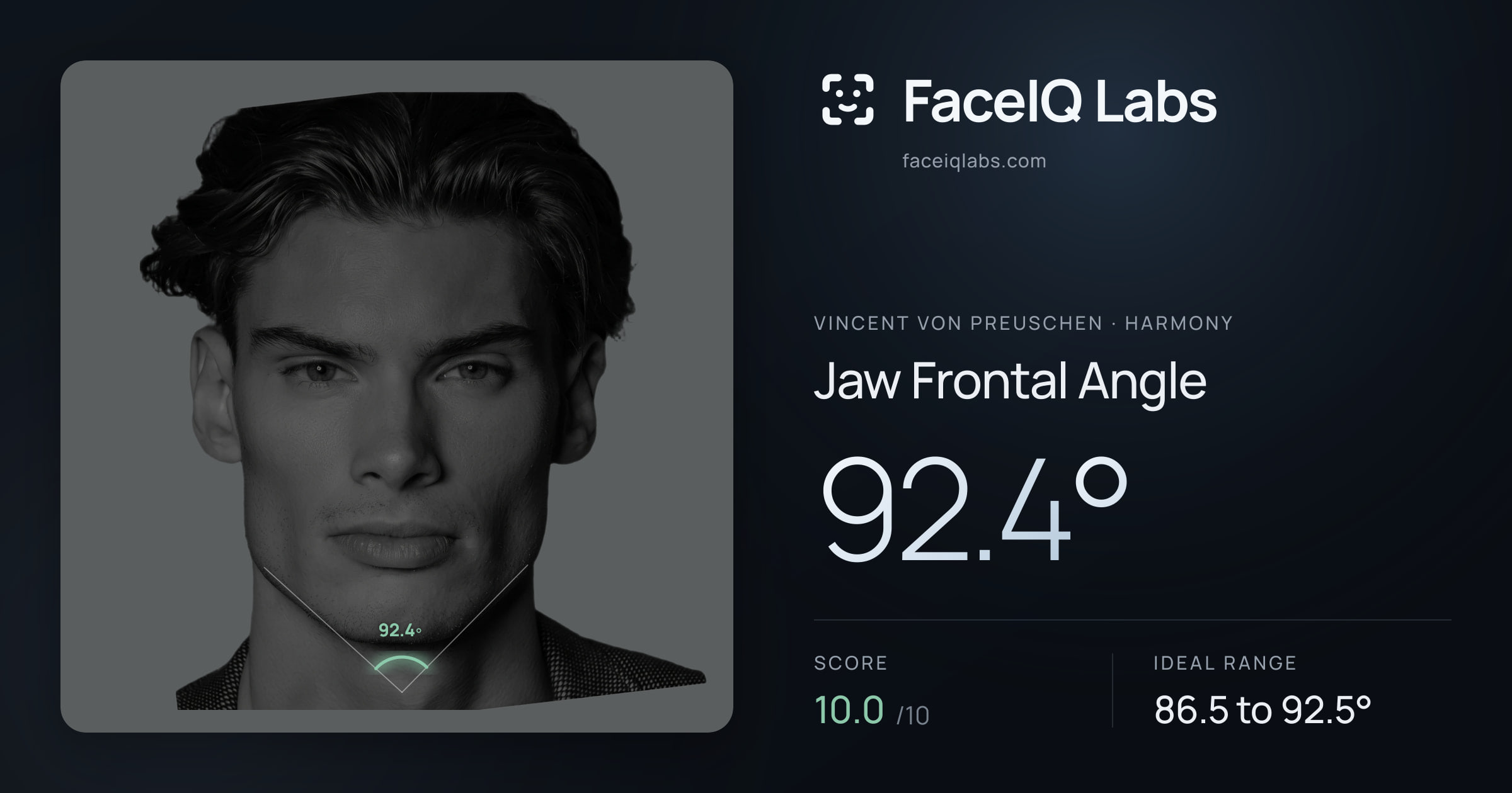 Vincent von Preuschen Jaw Frontal Angle: 92.4°, drawn on the photo