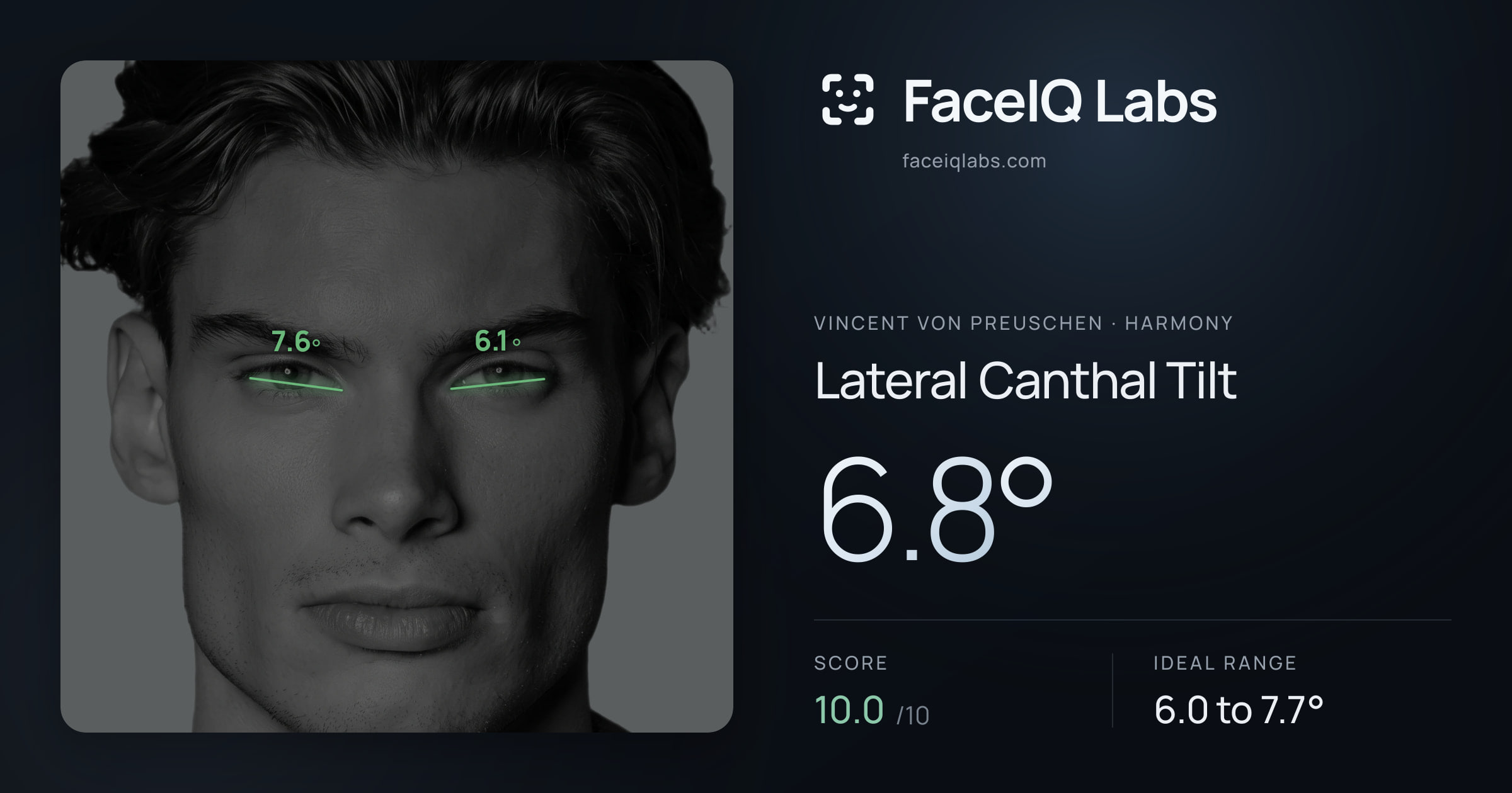 Vincent von Preuschen Lateral Canthal Tilt: 6.8°, drawn on the photo