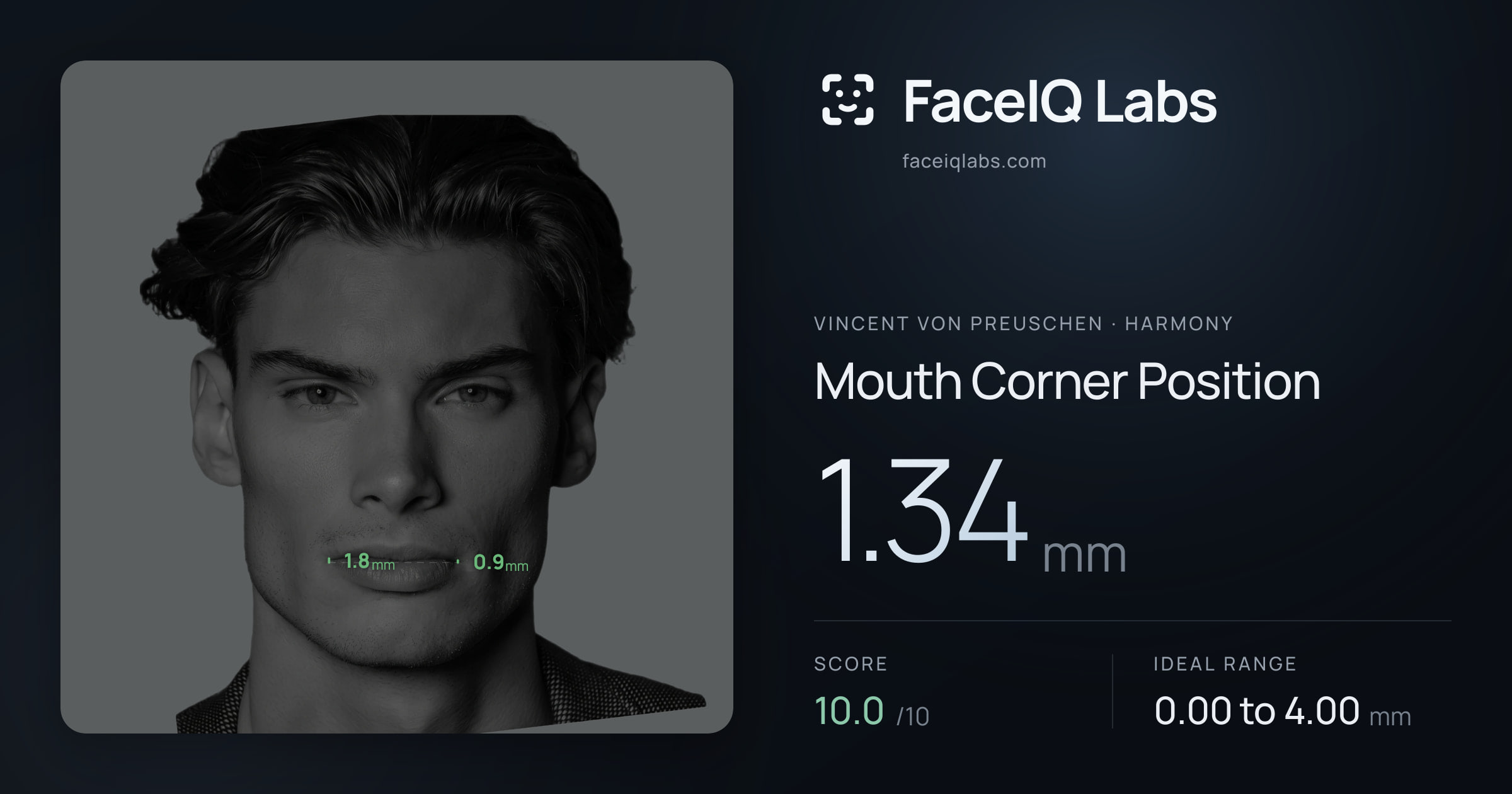 Vincent von Preuschen Mouth Corner Position: 1.34mm, drawn on the photo