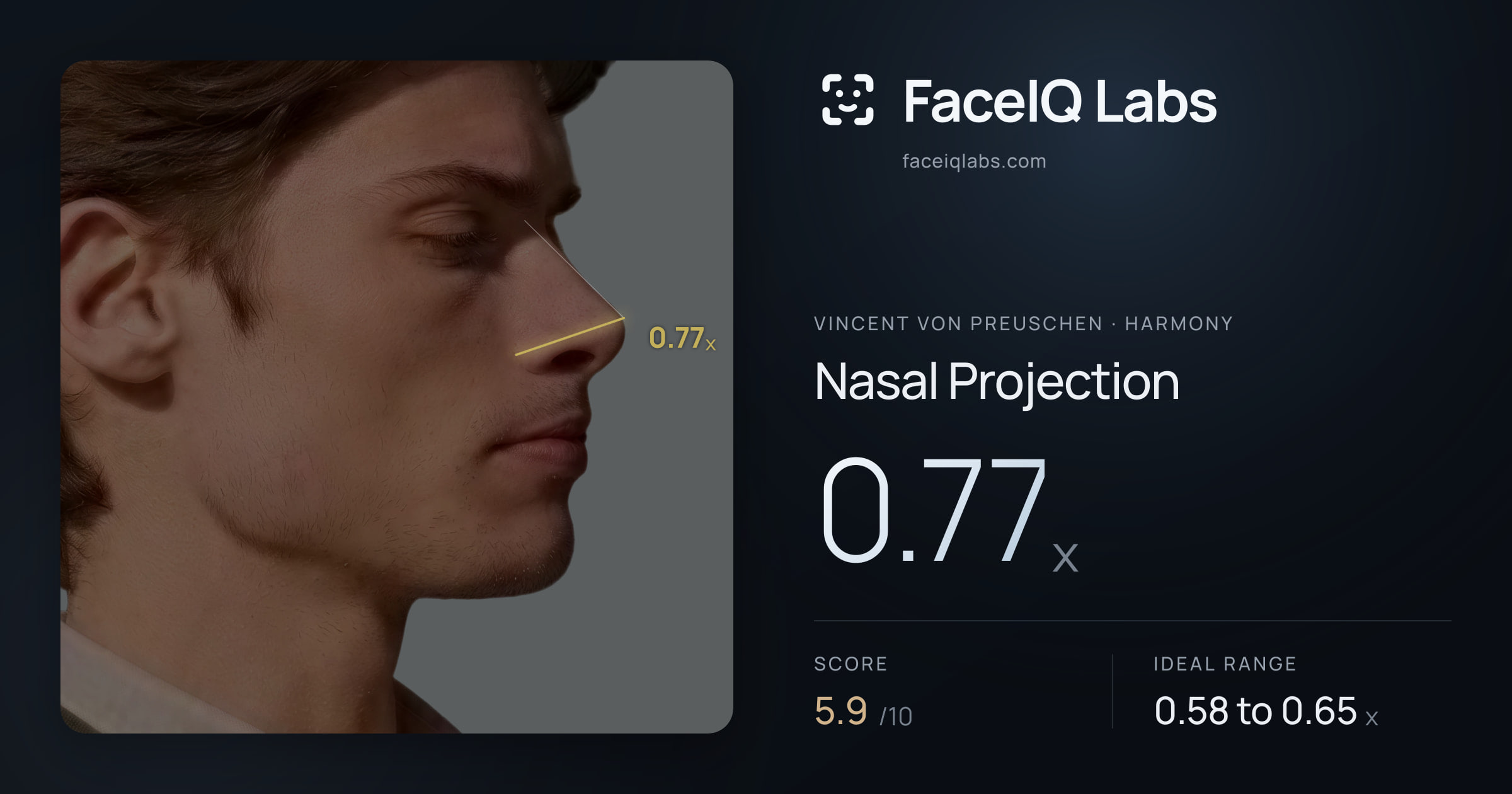 Vincent von Preuschen Nasal Projection: 0.77x, drawn on the photo