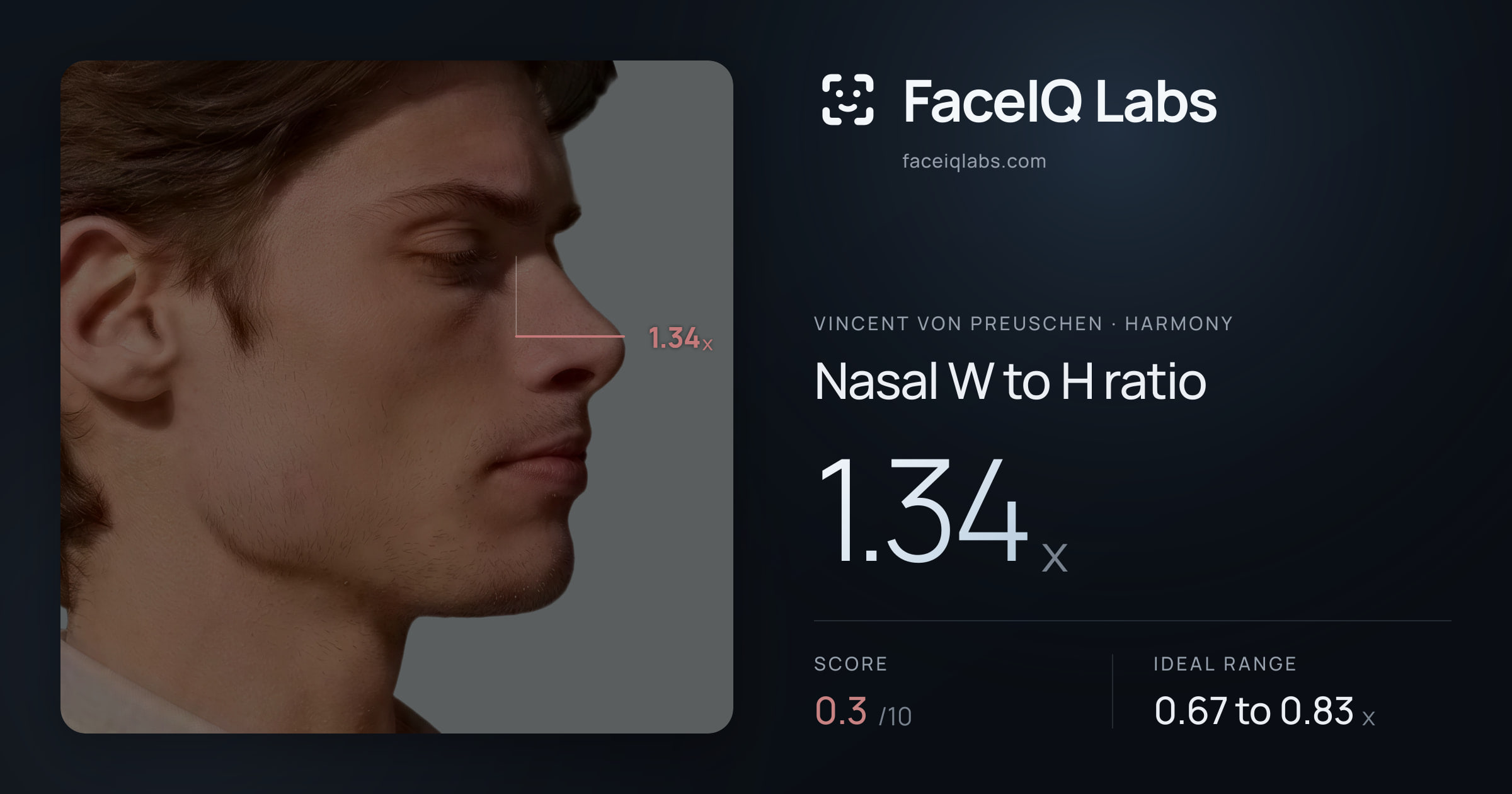 Vincent von Preuschen Nasal W to H ratio: 1.34x, drawn on the photo