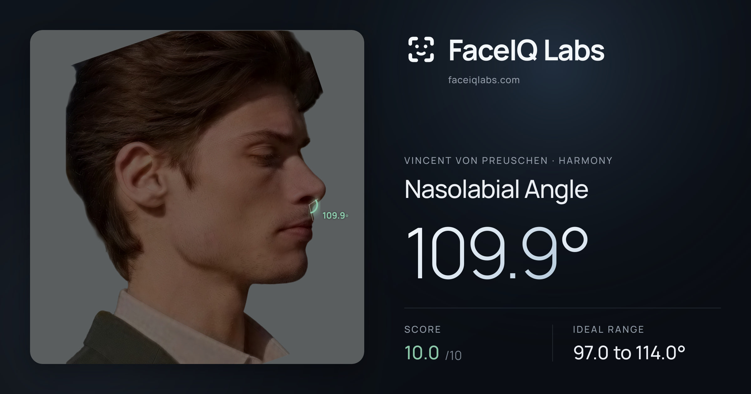 Vincent von Preuschen Nasolabial Angle: 109.9°, drawn on the photo