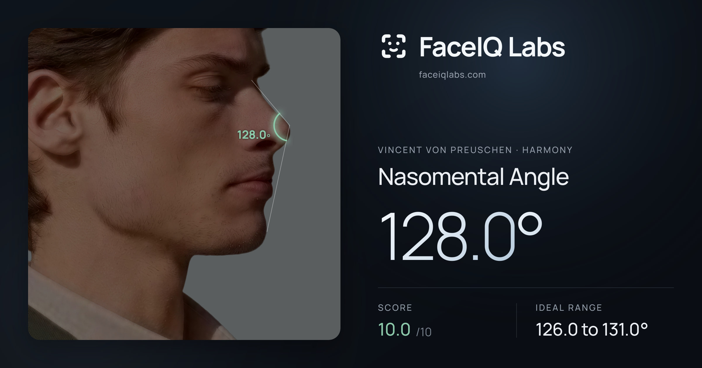 Vincent von Preuschen Nasomental Angle: 128.0°, drawn on the photo