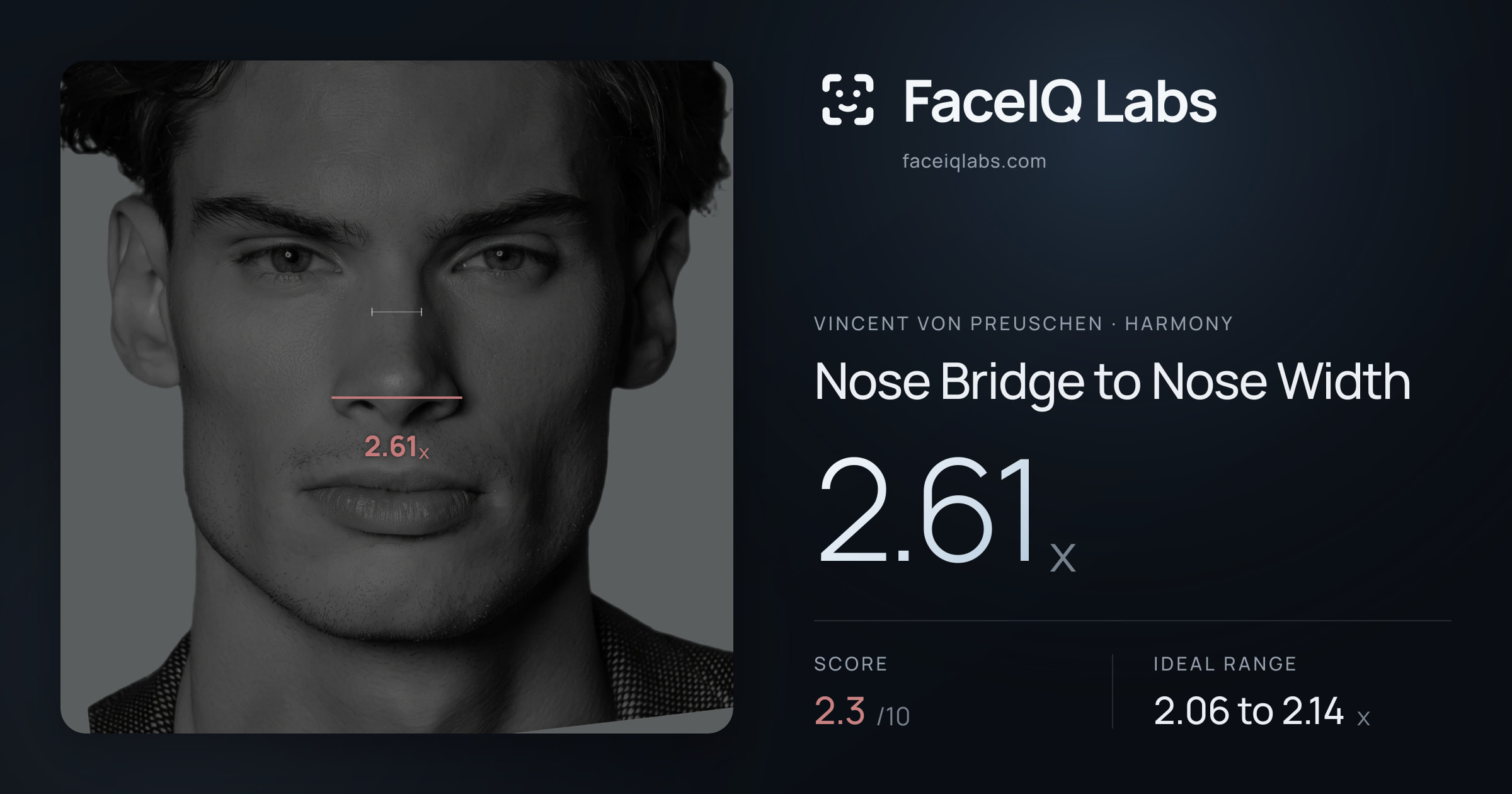 Vincent von Preuschen Nose Bridge to Nose Width: 2.61x, drawn on the photo