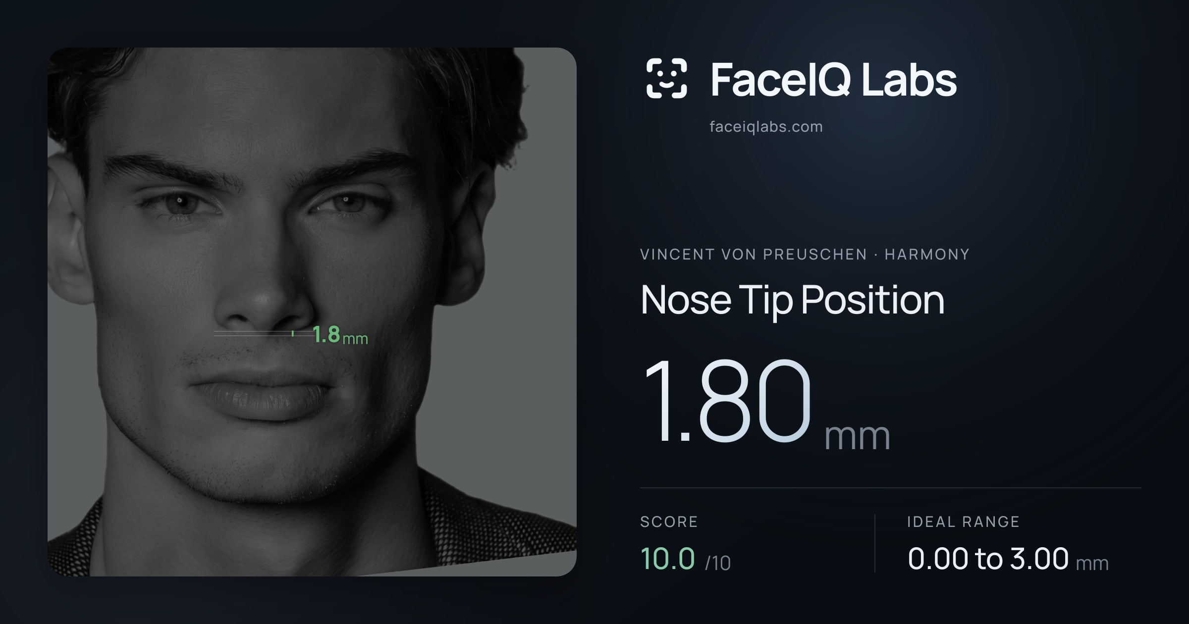 Vincent von Preuschen Nose Tip Position: 1.80mm, drawn on the photo