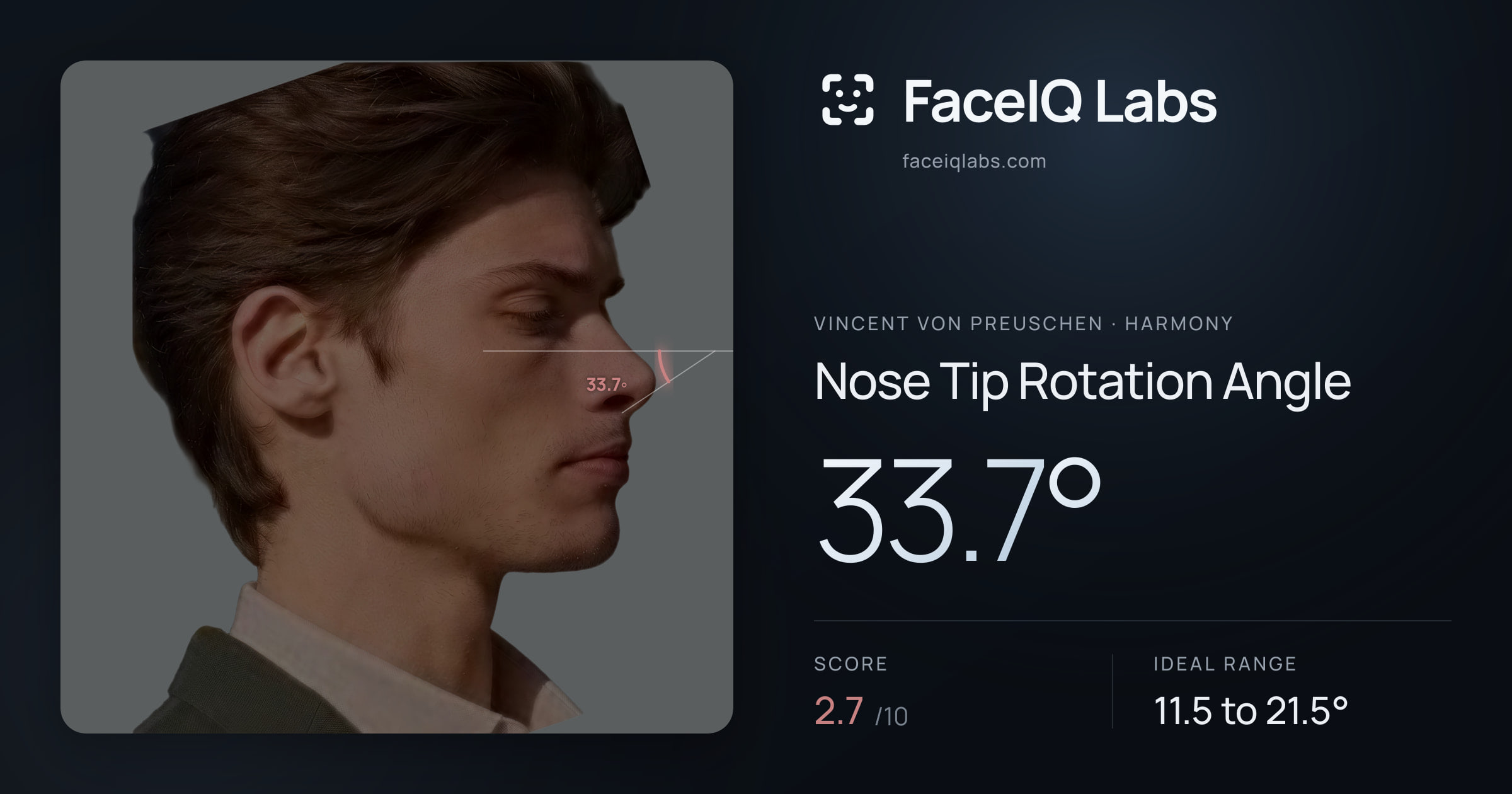Vincent von Preuschen Nose Tip Rotation Angle: 33.7°, drawn on the photo