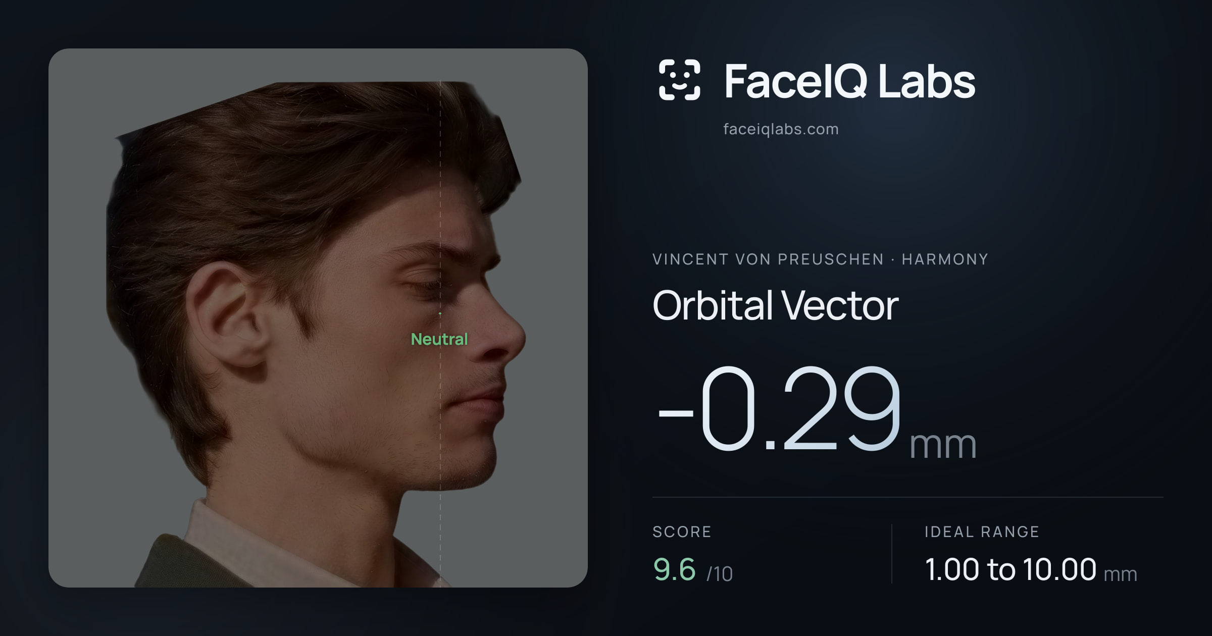 Vincent von Preuschen Orbital Vector: -0.29mm, drawn on the photo