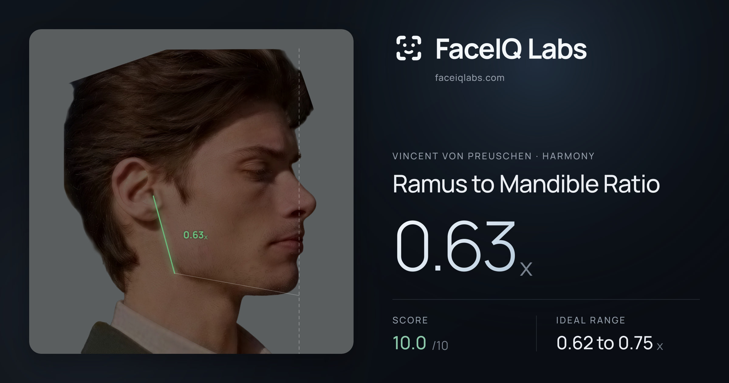 Vincent von Preuschen Ramus to Mandible Ratio: 0.63x, drawn on the photo