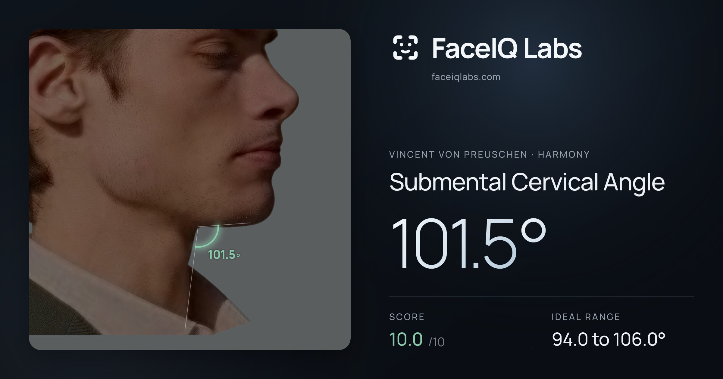 Vincent von Preuschen Submental Cervical Angle: 101.5°, drawn on the photo