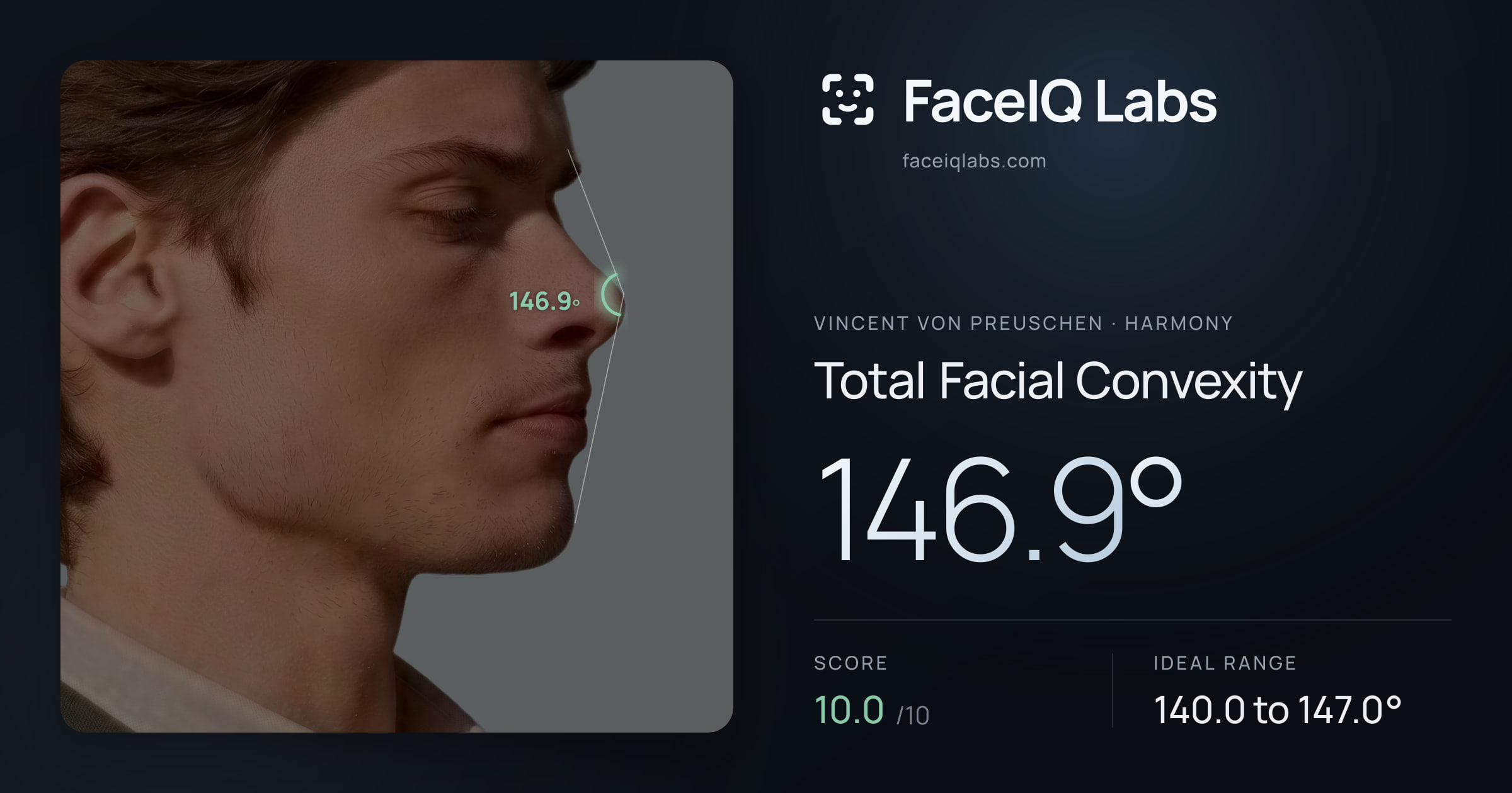 Vincent von Preuschen Total Facial Convexity: 146.9°, drawn on the photo