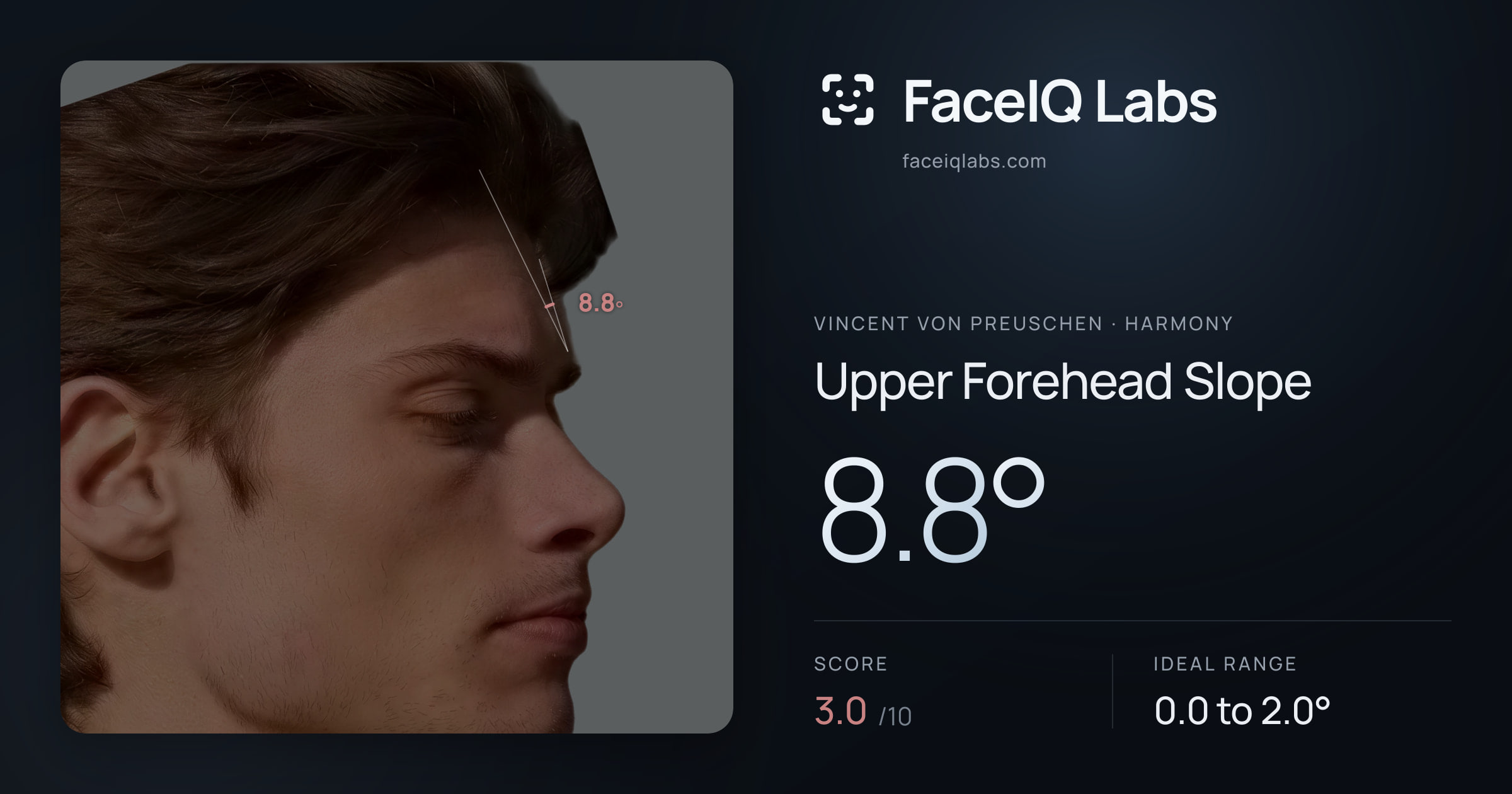 Vincent von Preuschen Upper Forehead Slope: 8.8°, drawn on the photo