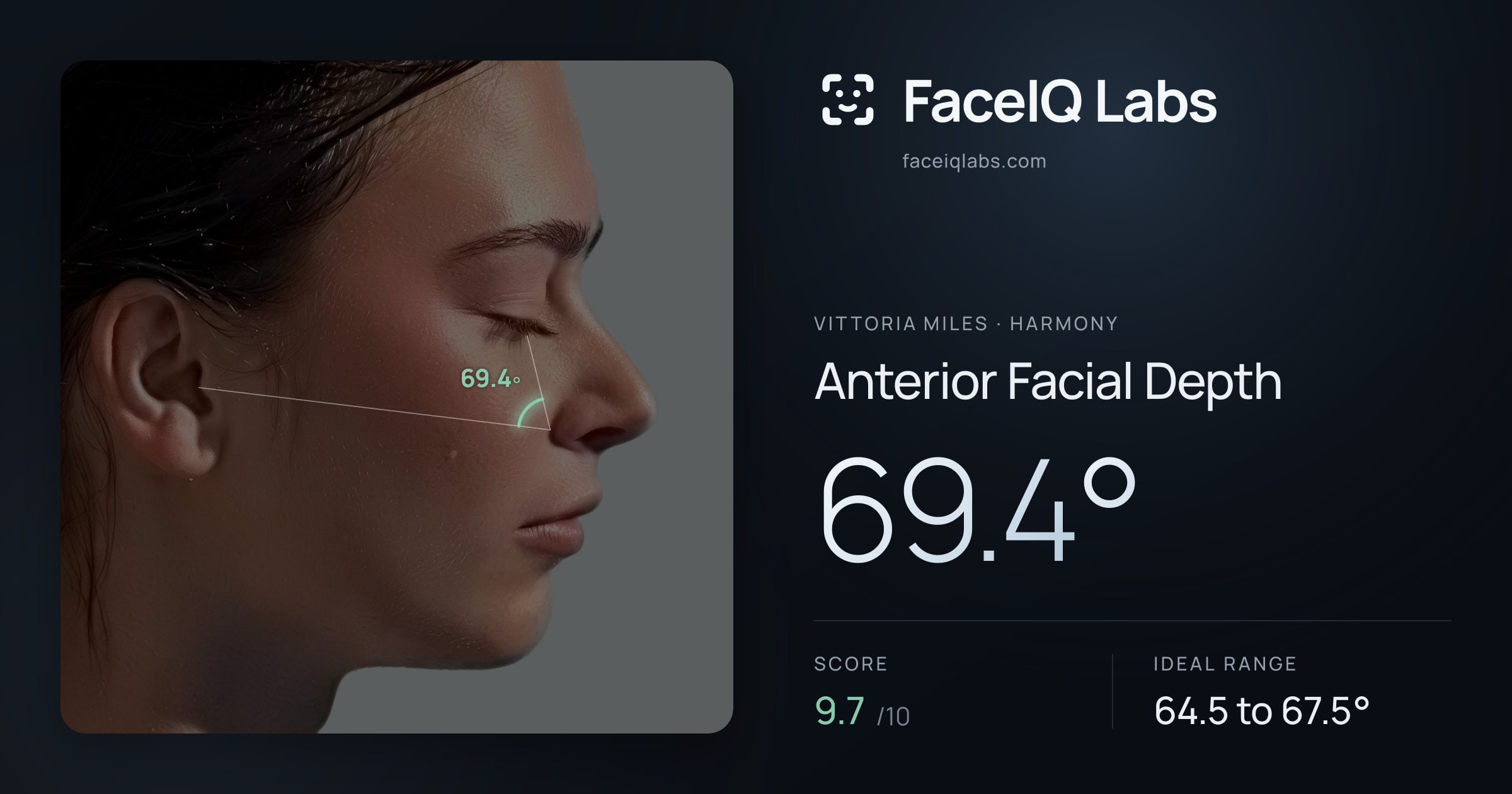 Vittoria Miles Anterior Facial Depth: 69.4°, drawn on the photo