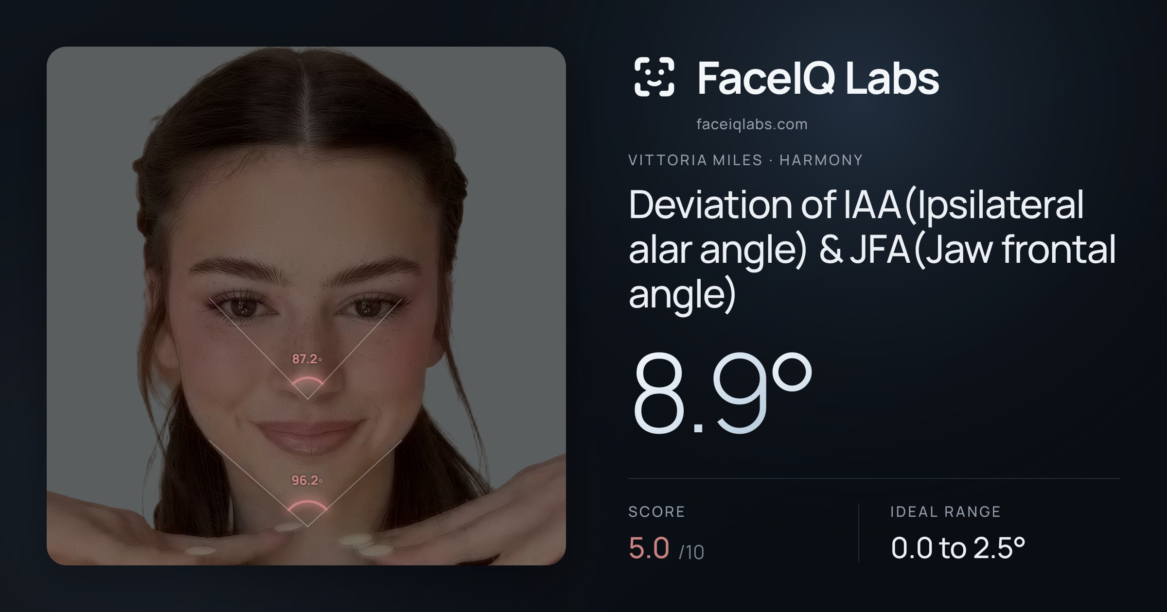 Vittoria Miles Deviation of IAA(Ipsilateral alar angle) & JFA(Jaw frontal angle): 8.9°, drawn on the photo