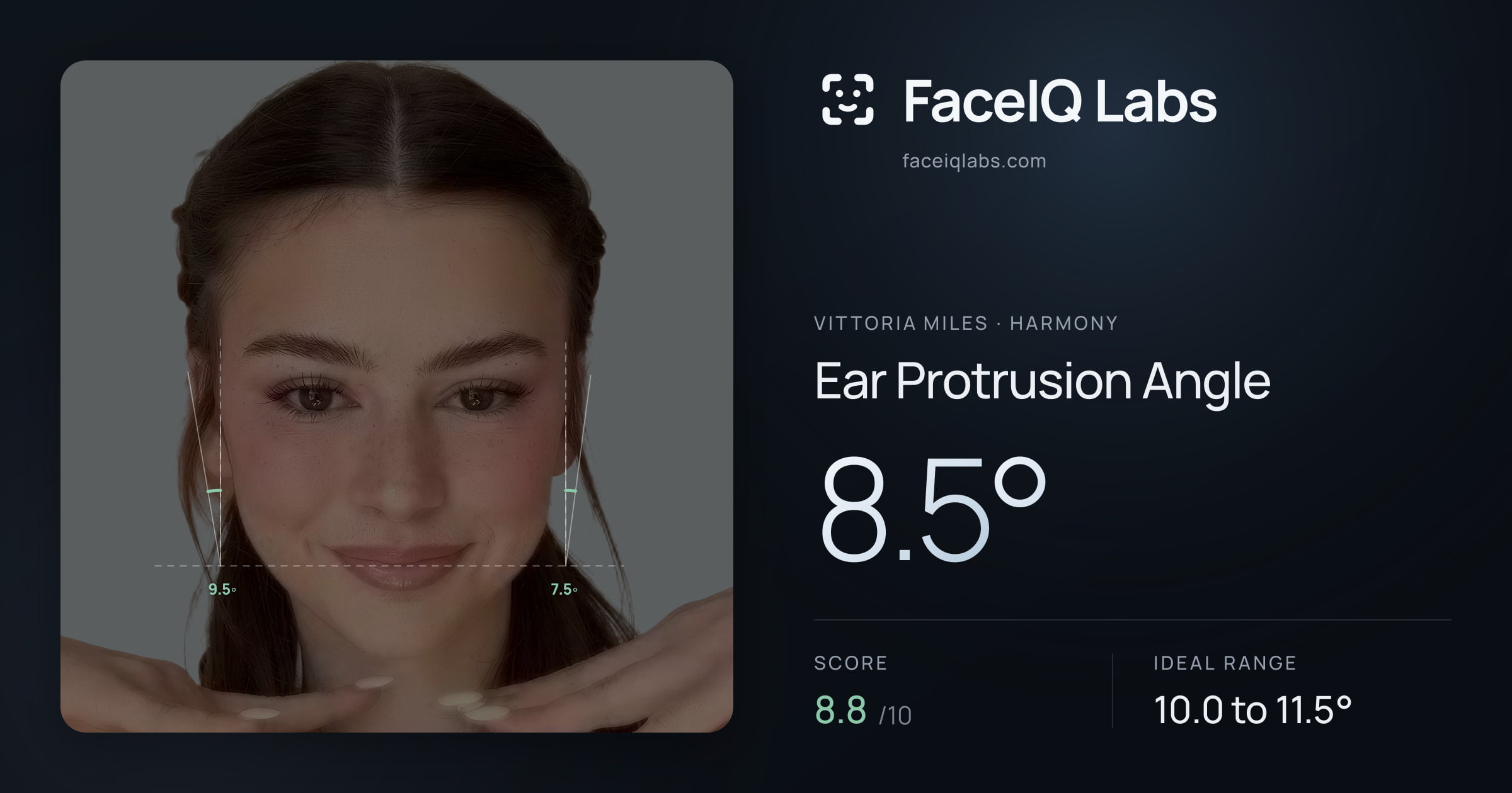 Vittoria Miles Ear Protrusion Angle: 8.5°, drawn on the photo