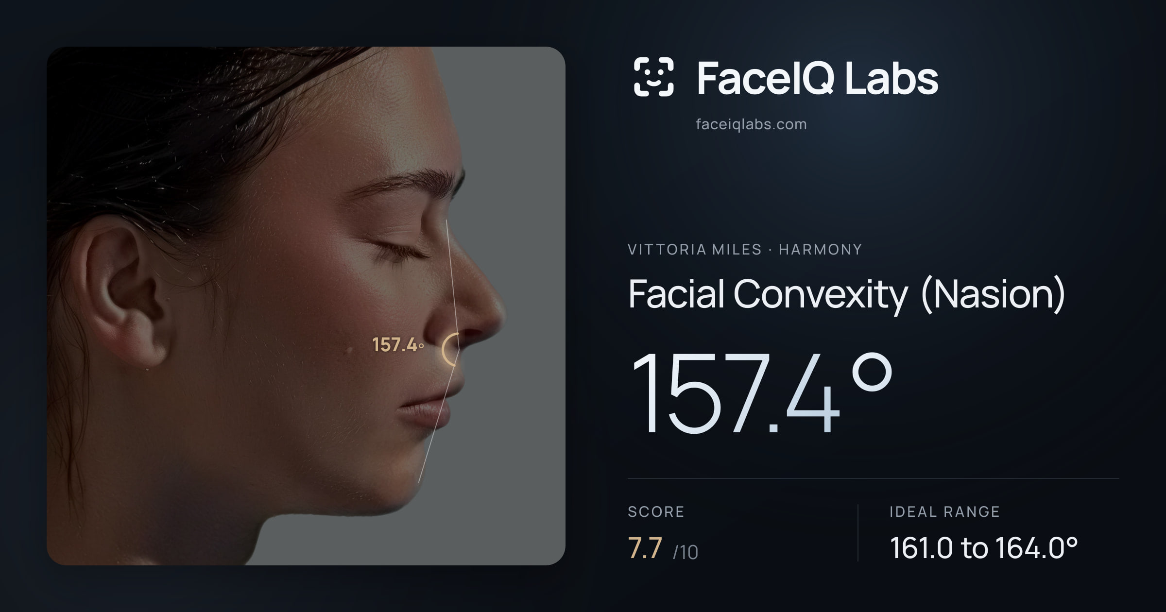 Vittoria Miles Facial Convexity (Nasion): 157.4°, drawn on the photo