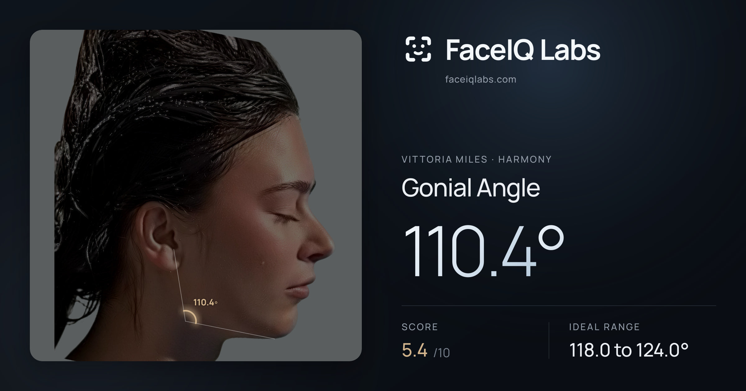 Vittoria Miles Gonial Angle: 110.4°, drawn on the photo