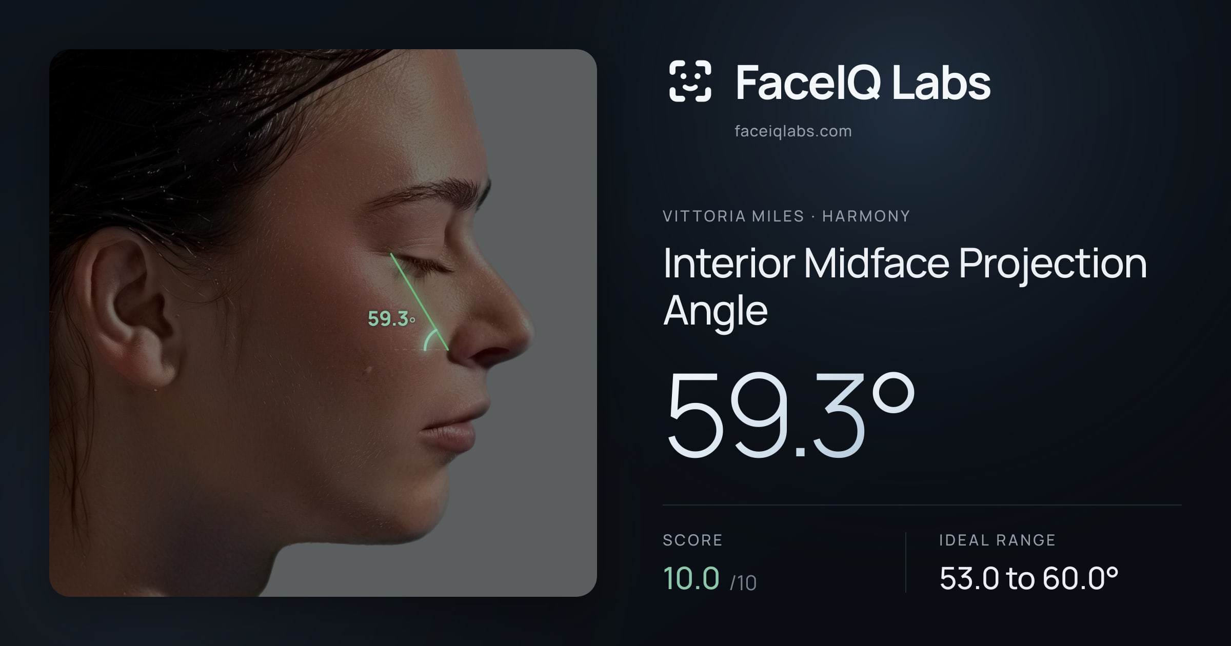 Vittoria Miles Interior Midface Projection Angle: 59.3°, drawn on the photo