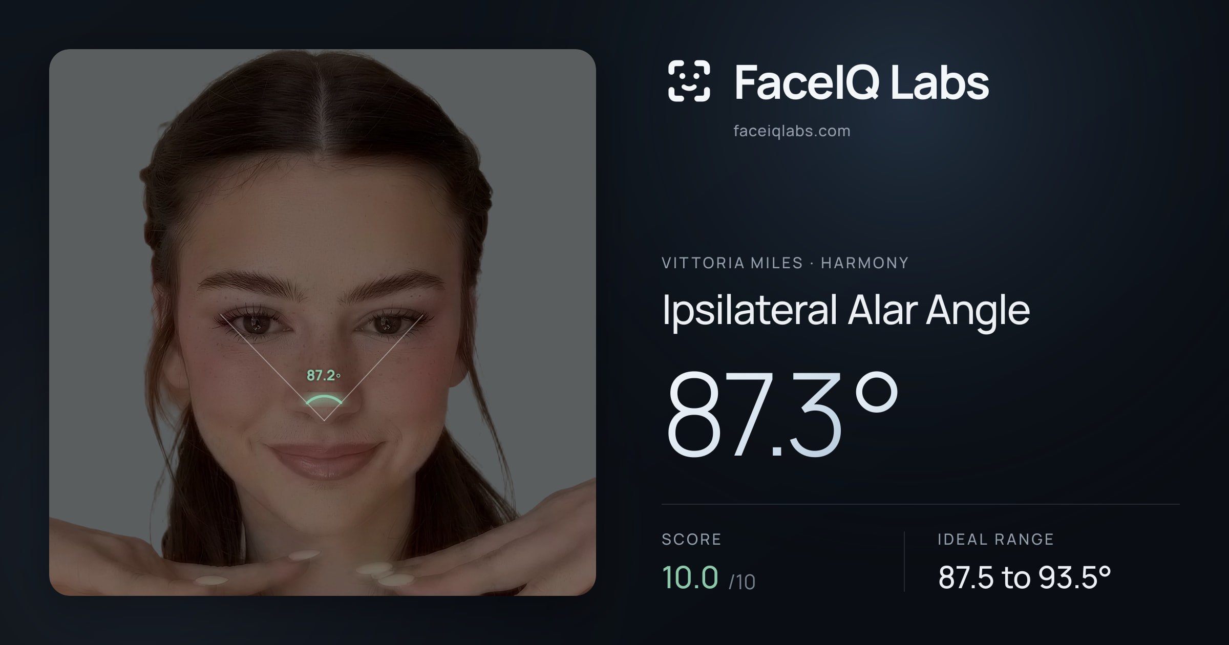 Vittoria Miles Ipsilateral Alar Angle: 87.3°, drawn on the photo