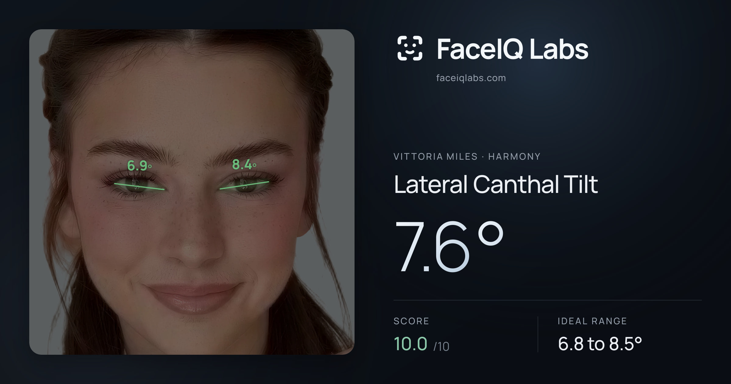 Vittoria Miles Lateral Canthal Tilt: 7.6°, drawn on the photo