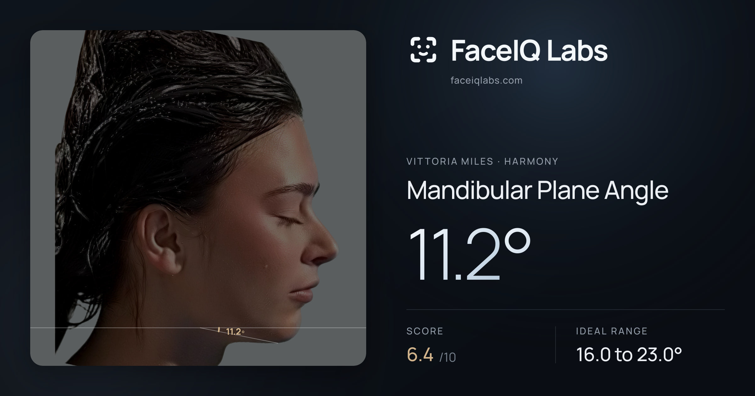 Vittoria Miles Mandibular Plane Angle: 11.2°, drawn on the photo