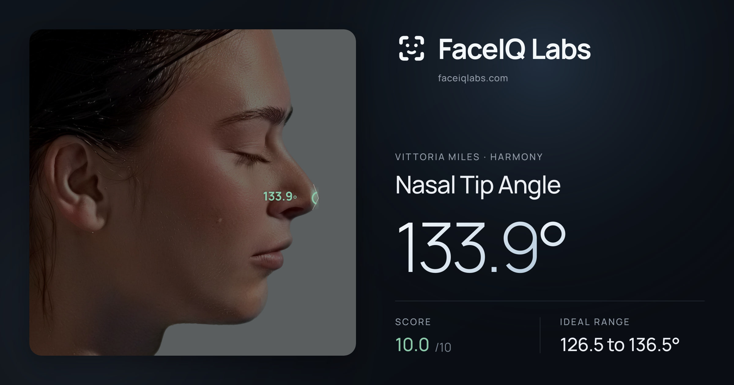 Vittoria Miles Nasal Tip Angle: 133.9°, drawn on the photo