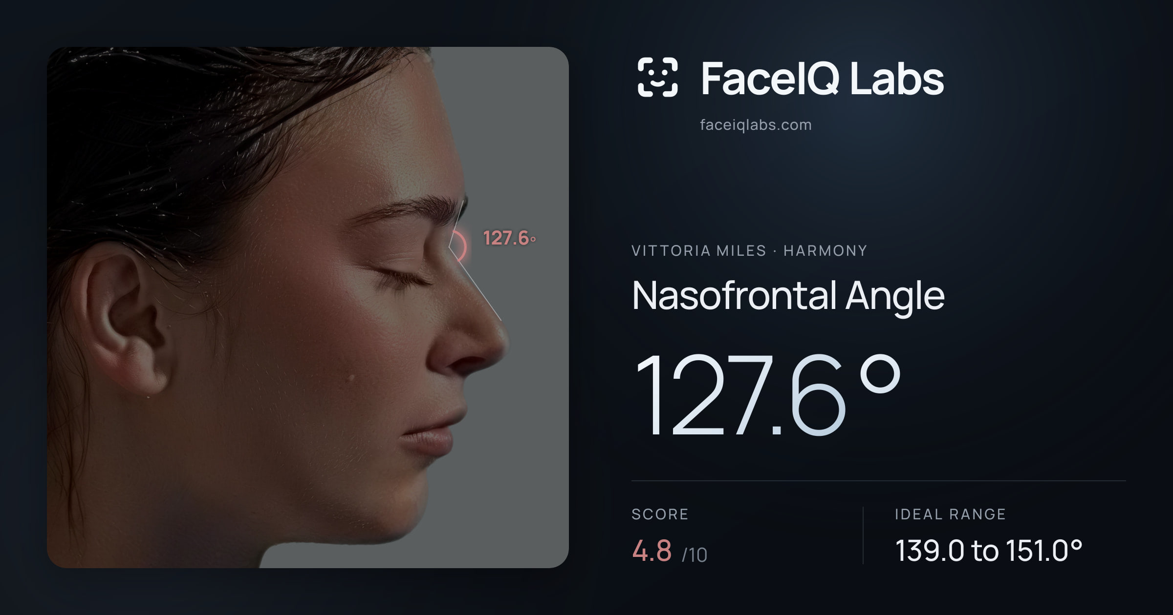 Vittoria Miles Nasofrontal Angle: 127.6°, drawn on the photo