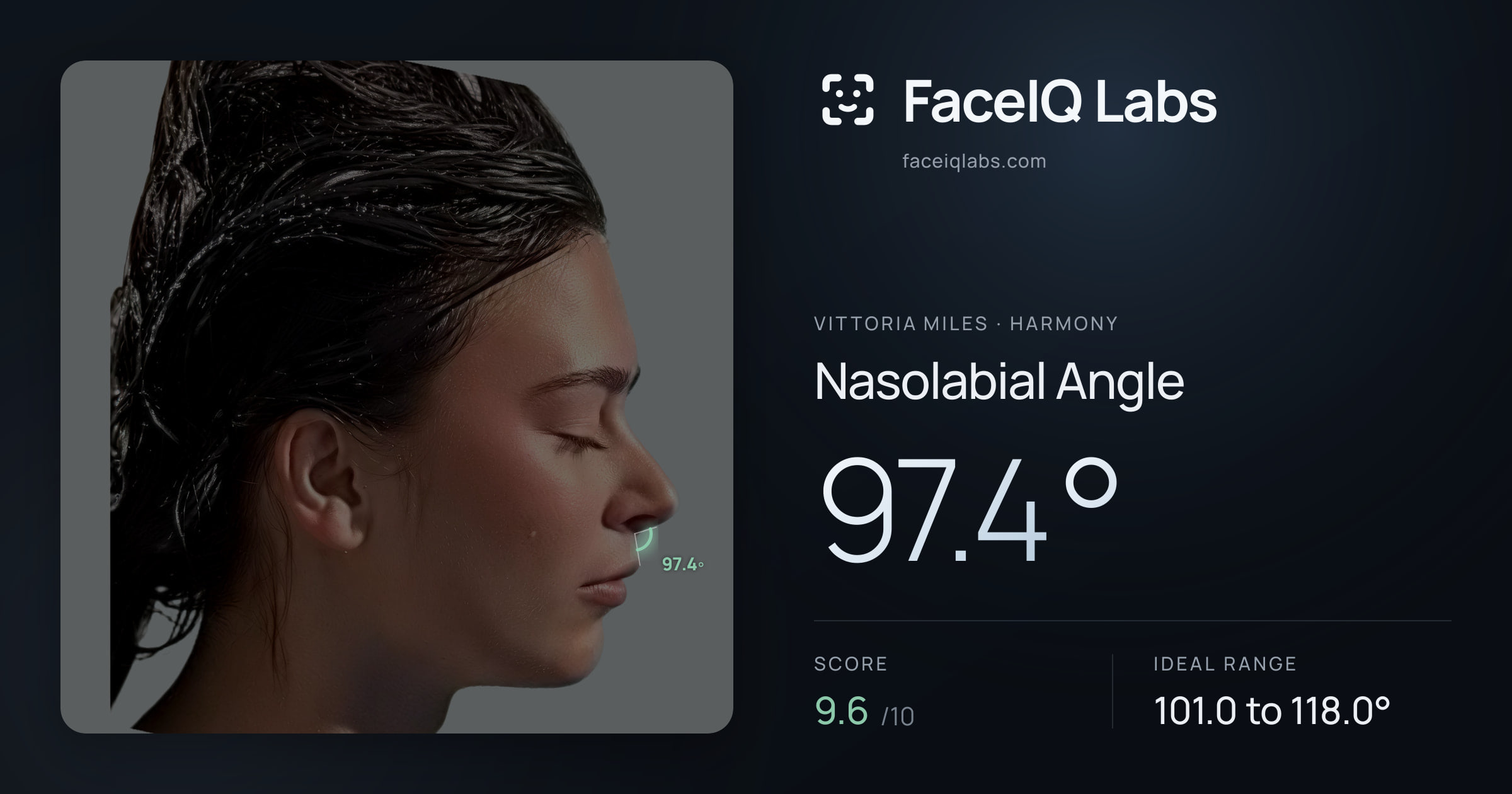 Vittoria Miles Nasolabial Angle: 97.4°, drawn on the photo