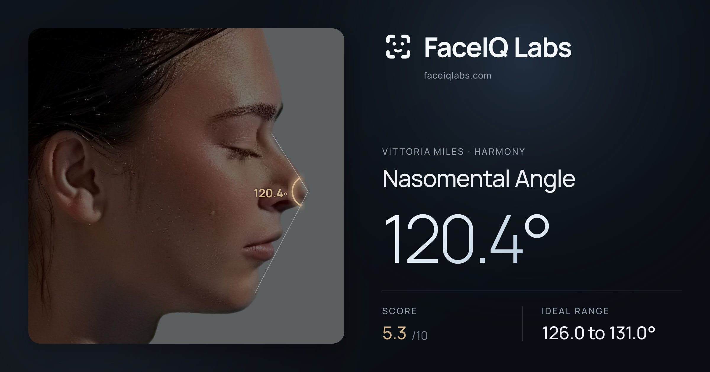 Vittoria Miles Nasomental Angle: 120.4°, drawn on the photo