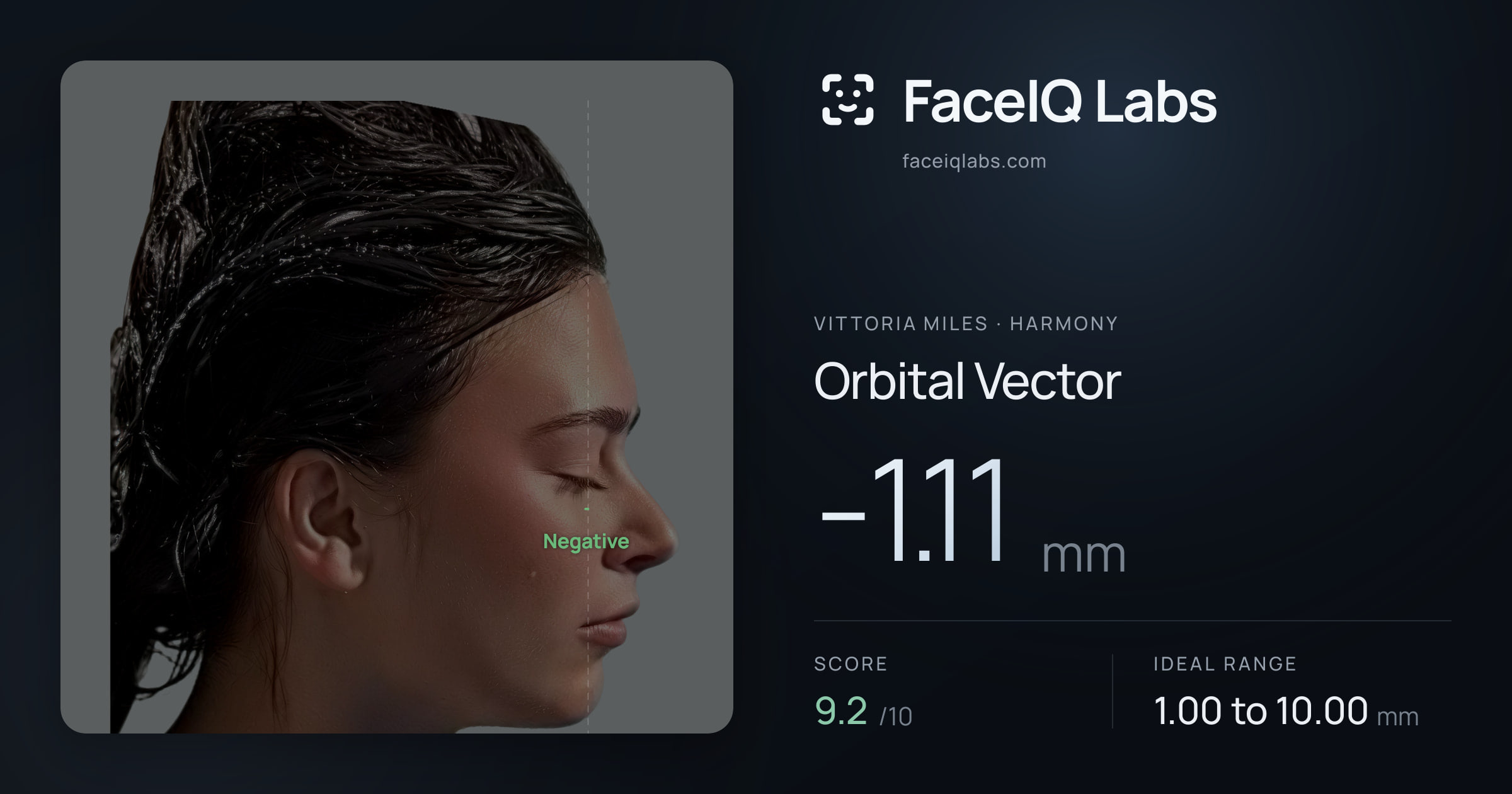 Vittoria Miles Orbital Vector: -1.11mm, drawn on the photo