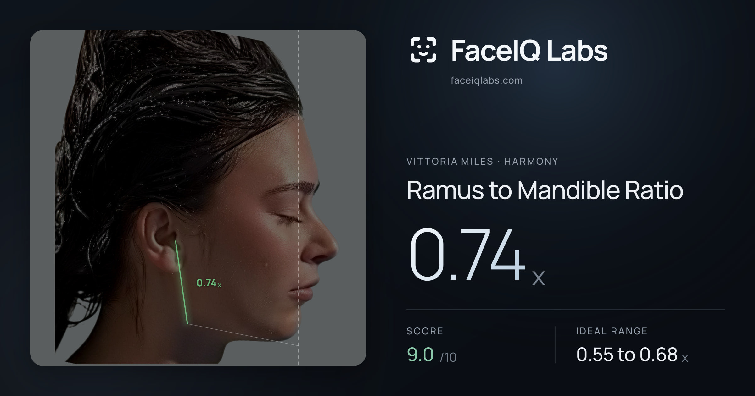 Vittoria Miles Ramus to Mandible Ratio: 0.74x, drawn on the photo