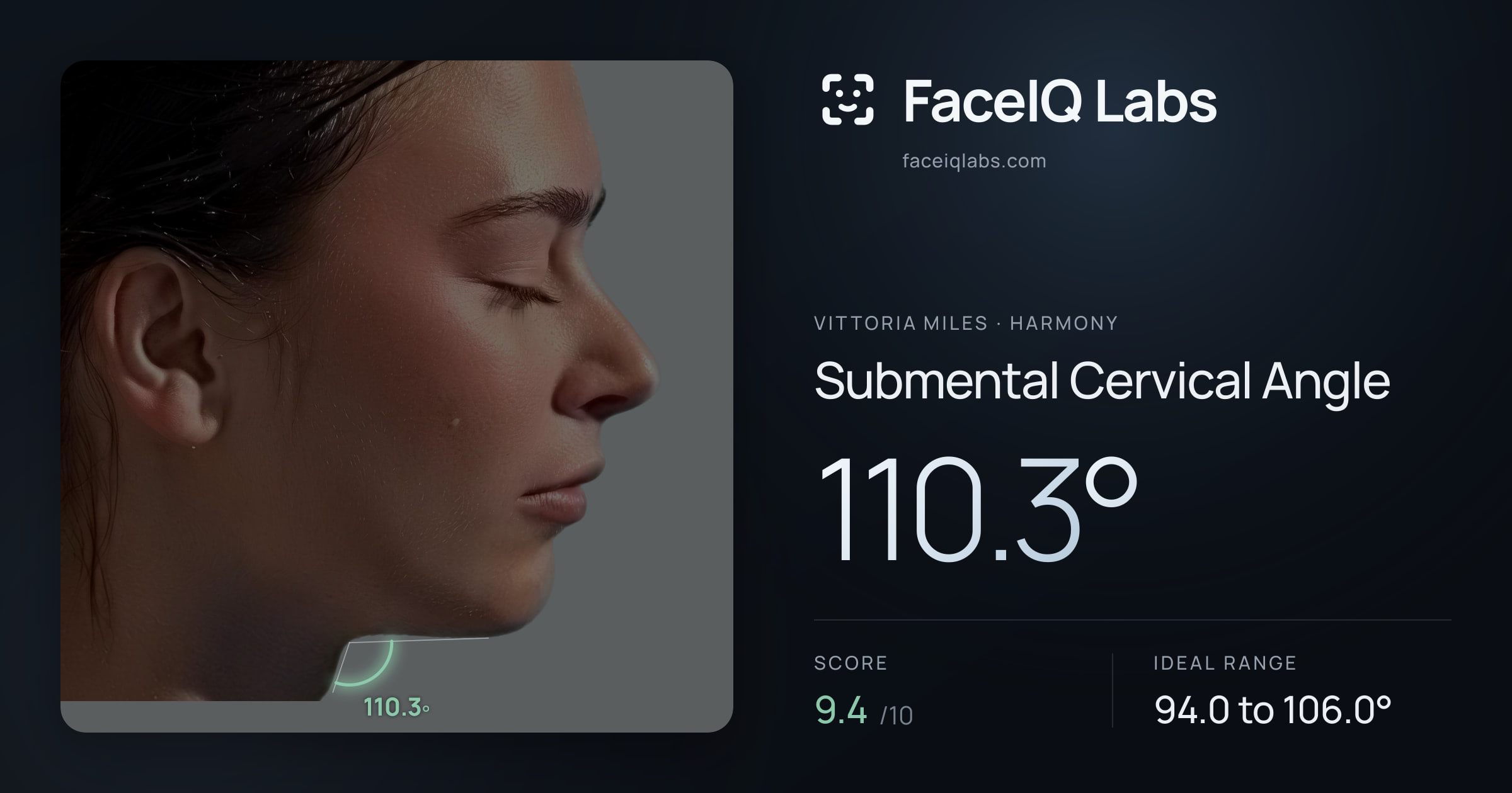 Vittoria Miles Submental Cervical Angle: 110.3°, drawn on the photo
