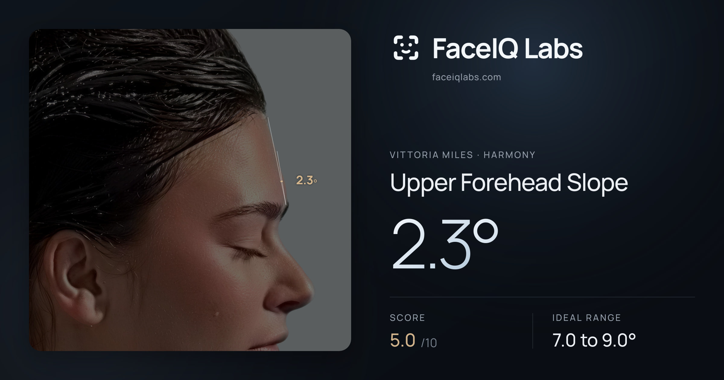 Vittoria Miles Upper Forehead Slope: 2.3°, drawn on the photo