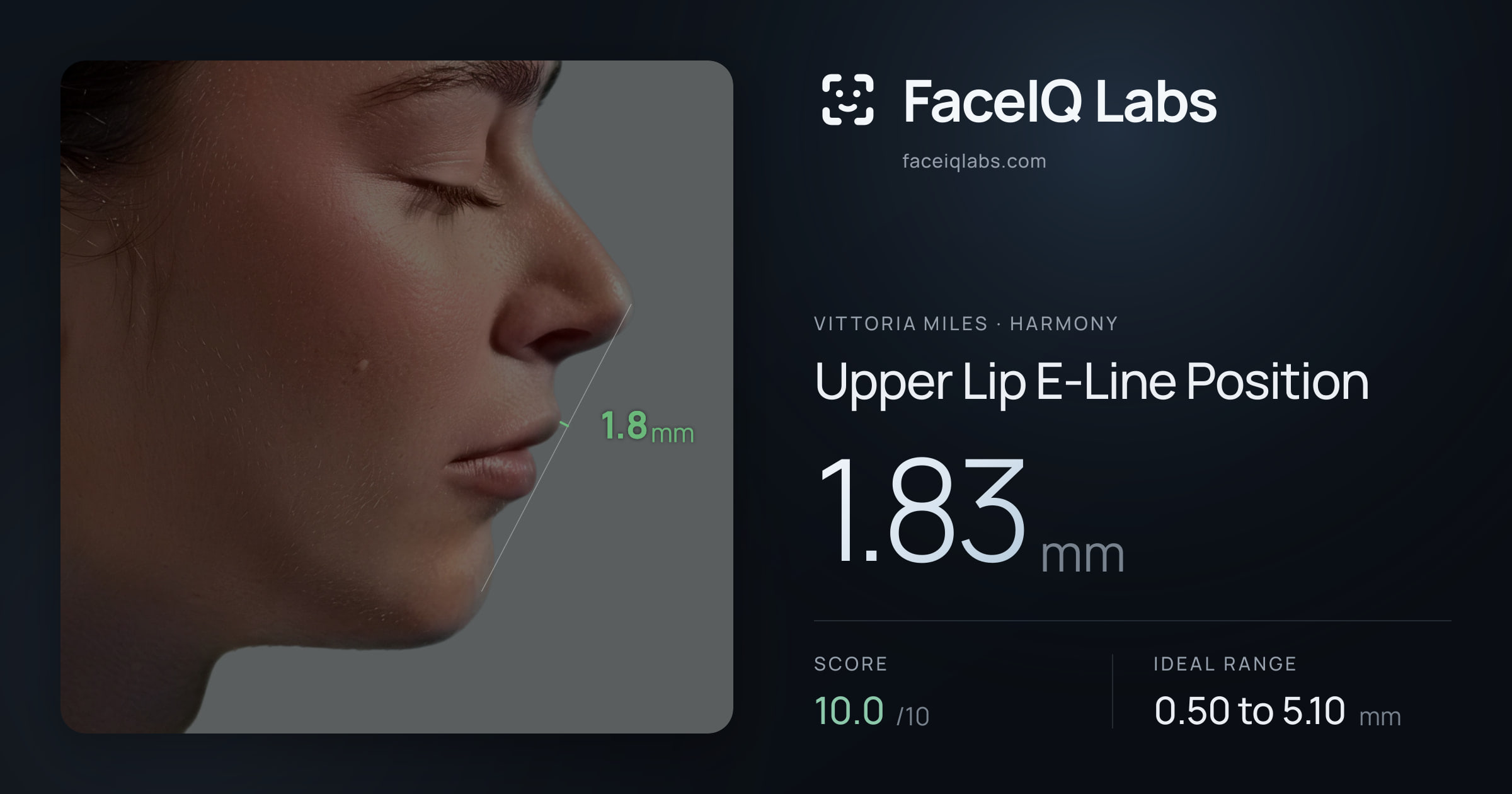 Vittoria Miles Upper Lip E-Line Position: 1.83mm, drawn on the photo