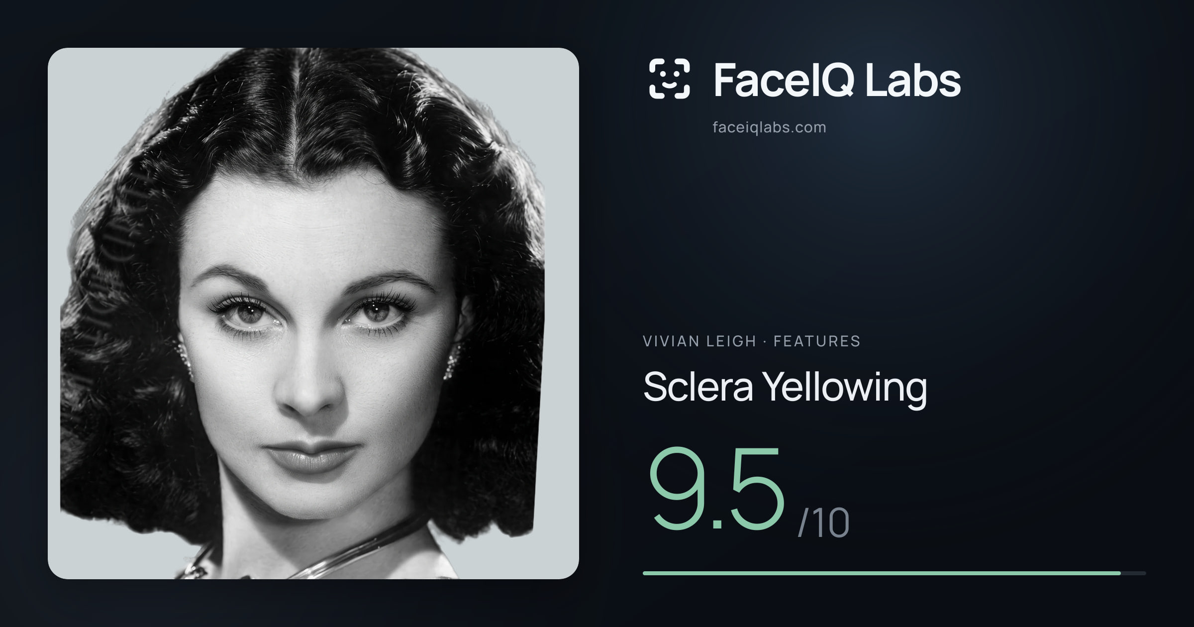 Vivian Leigh Sclera Yellowing: 9.5/10, drawn on the photo