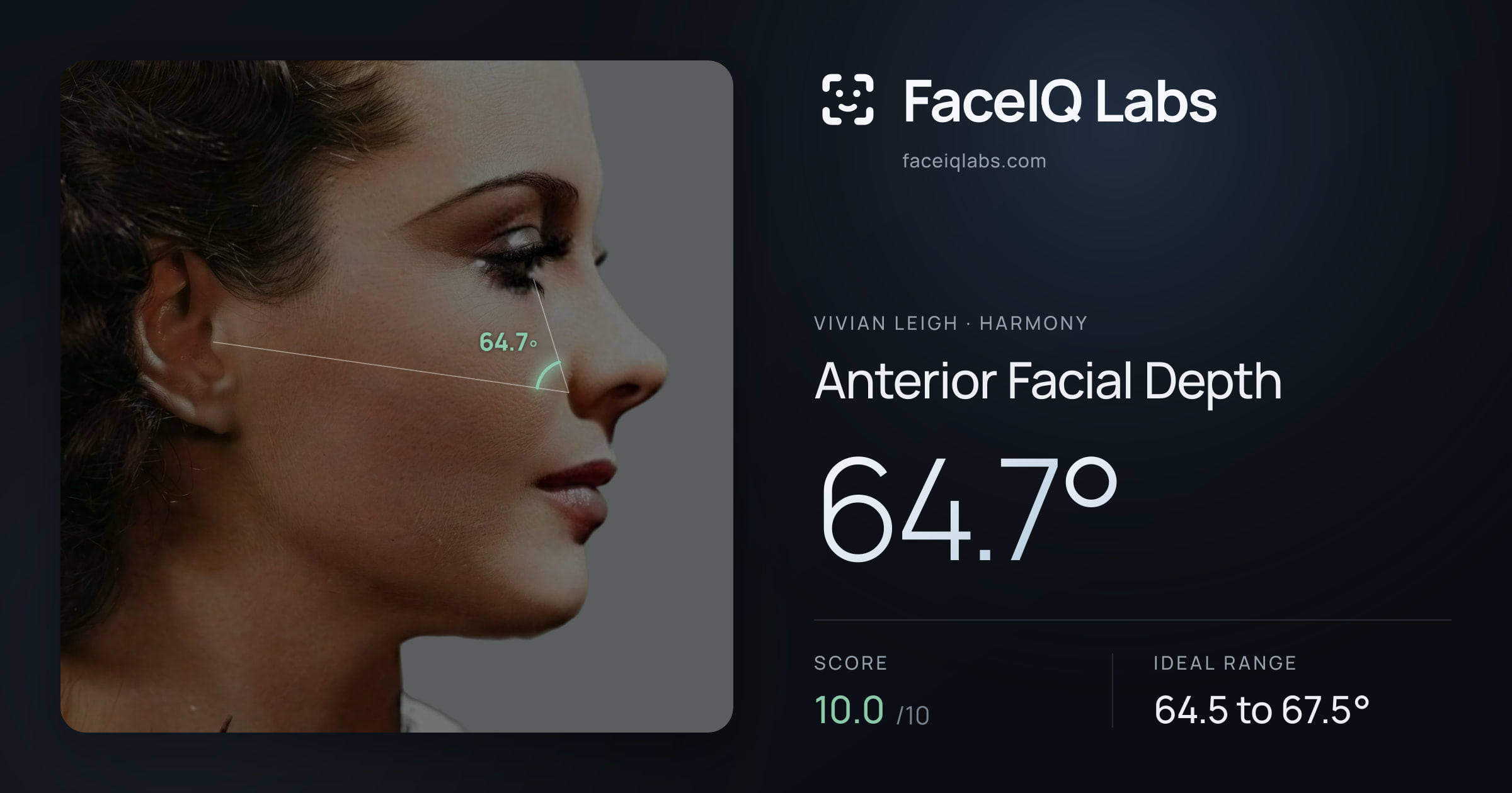Vivian Leigh Anterior Facial Depth: 64.7°, drawn on the photo