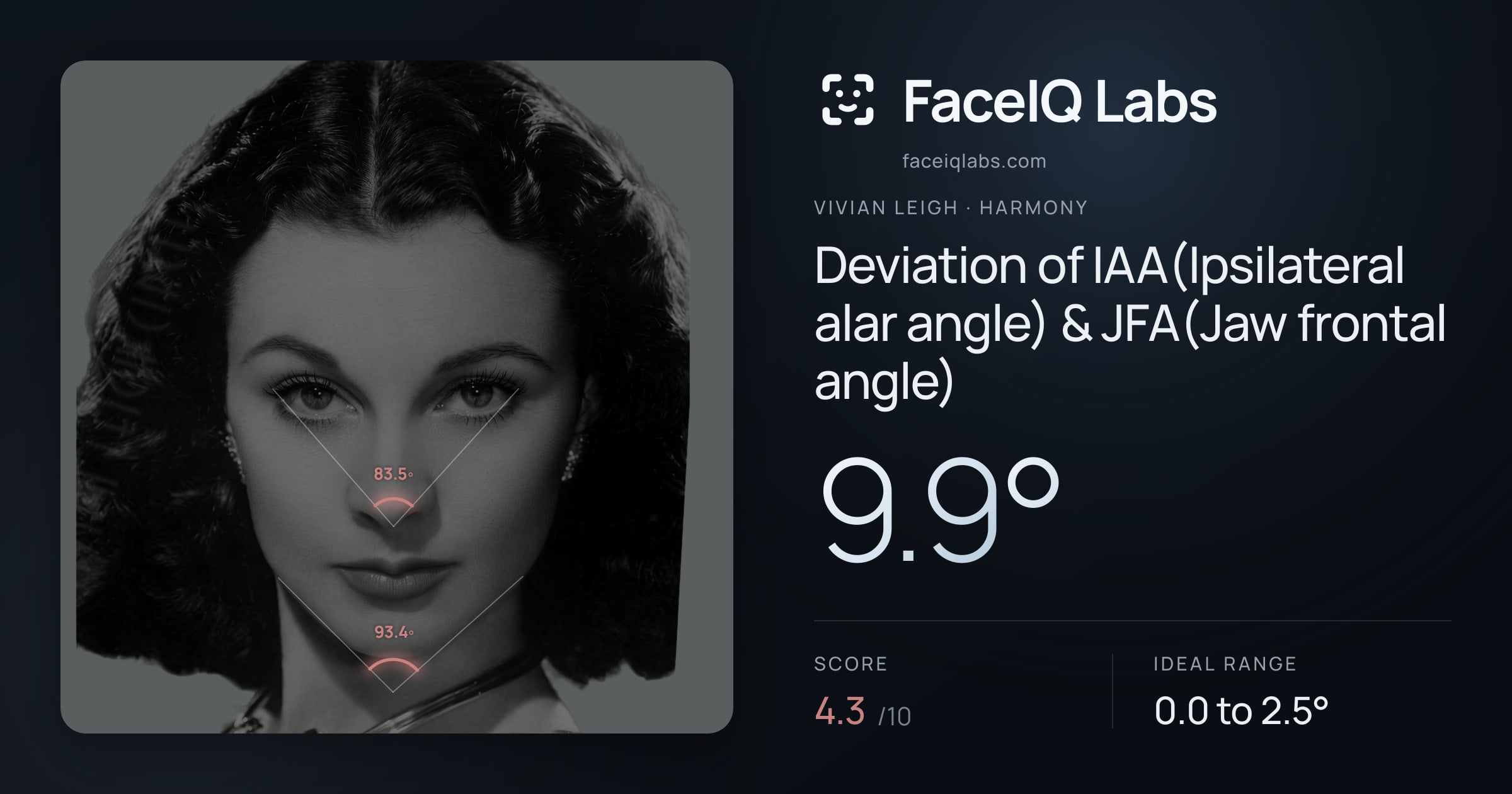 Vivian Leigh Deviation of IAA(Ipsilateral alar angle) & JFA(Jaw frontal angle): 9.9°, drawn on the photo